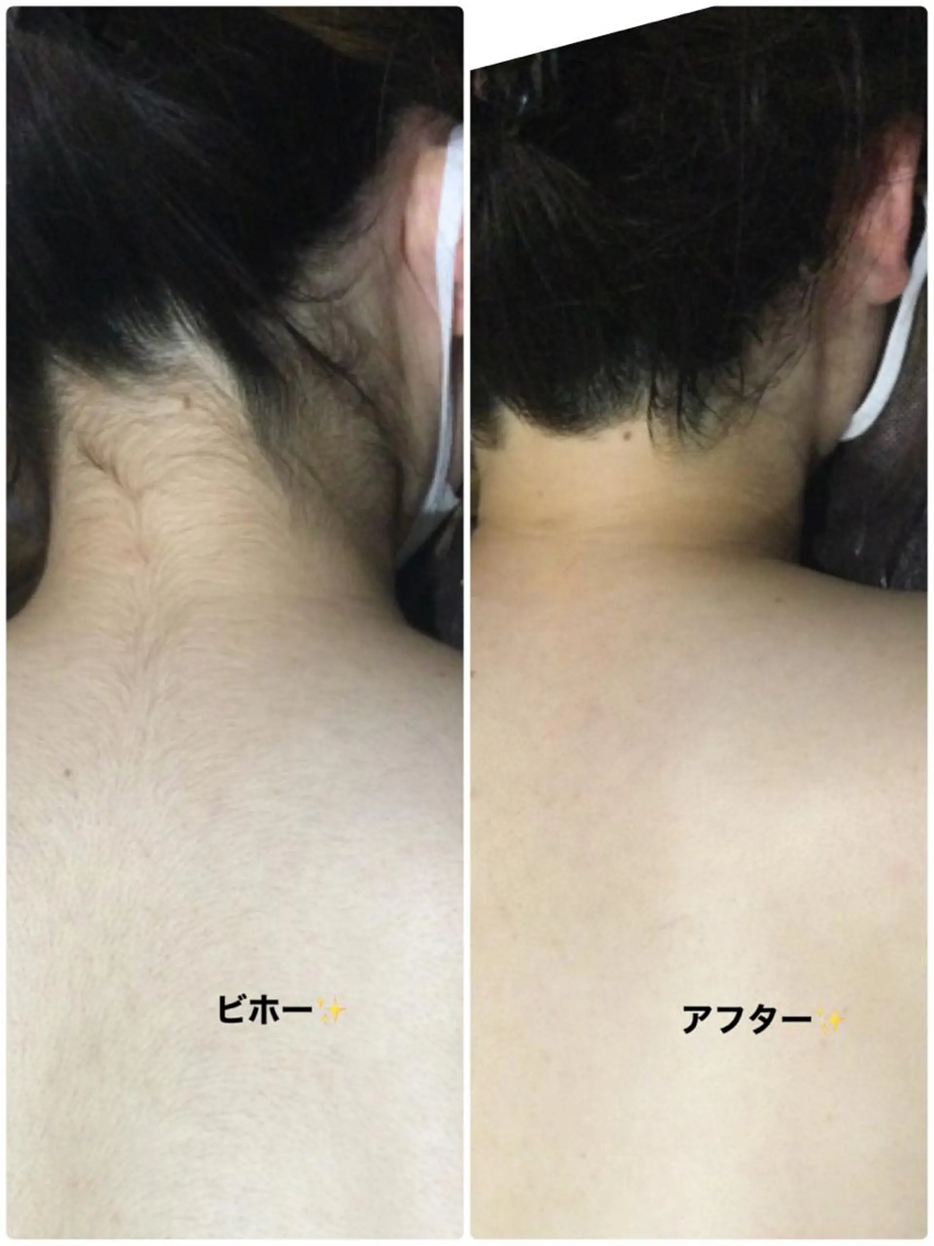 脱毛 Ange vivalavidaのエステ・リラクイメージ