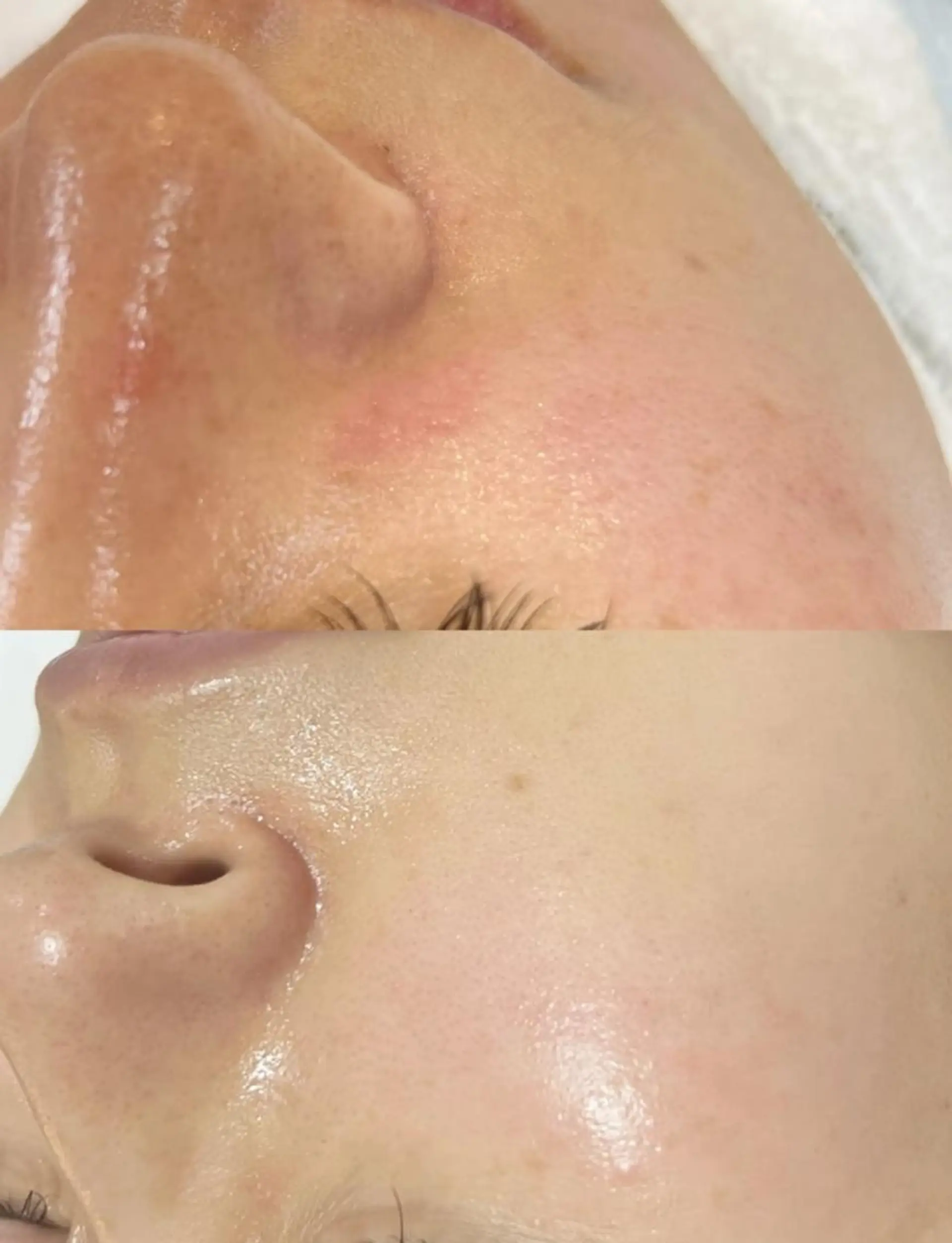 U・mi ユキのマツエク・マツパデザイン