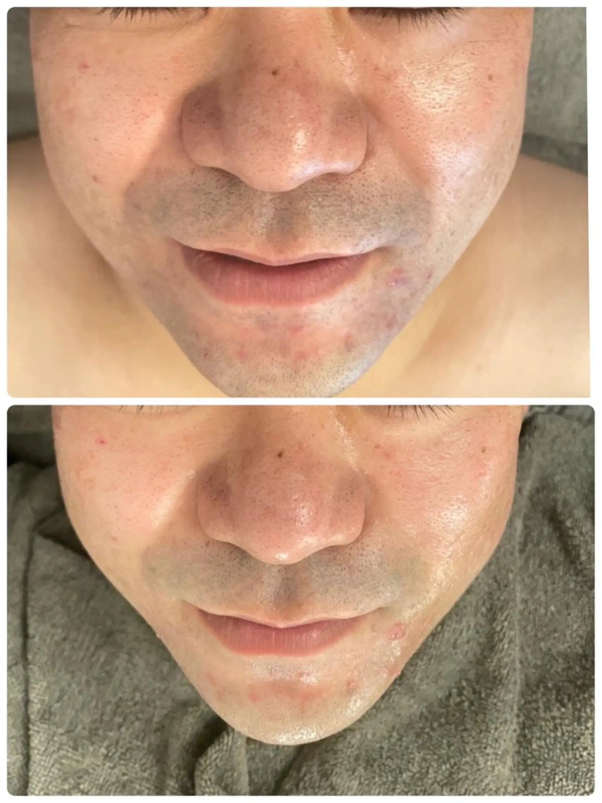 メンズ メンズフェイシャル アイブロウ・ルースのエステ・リラクイメージ