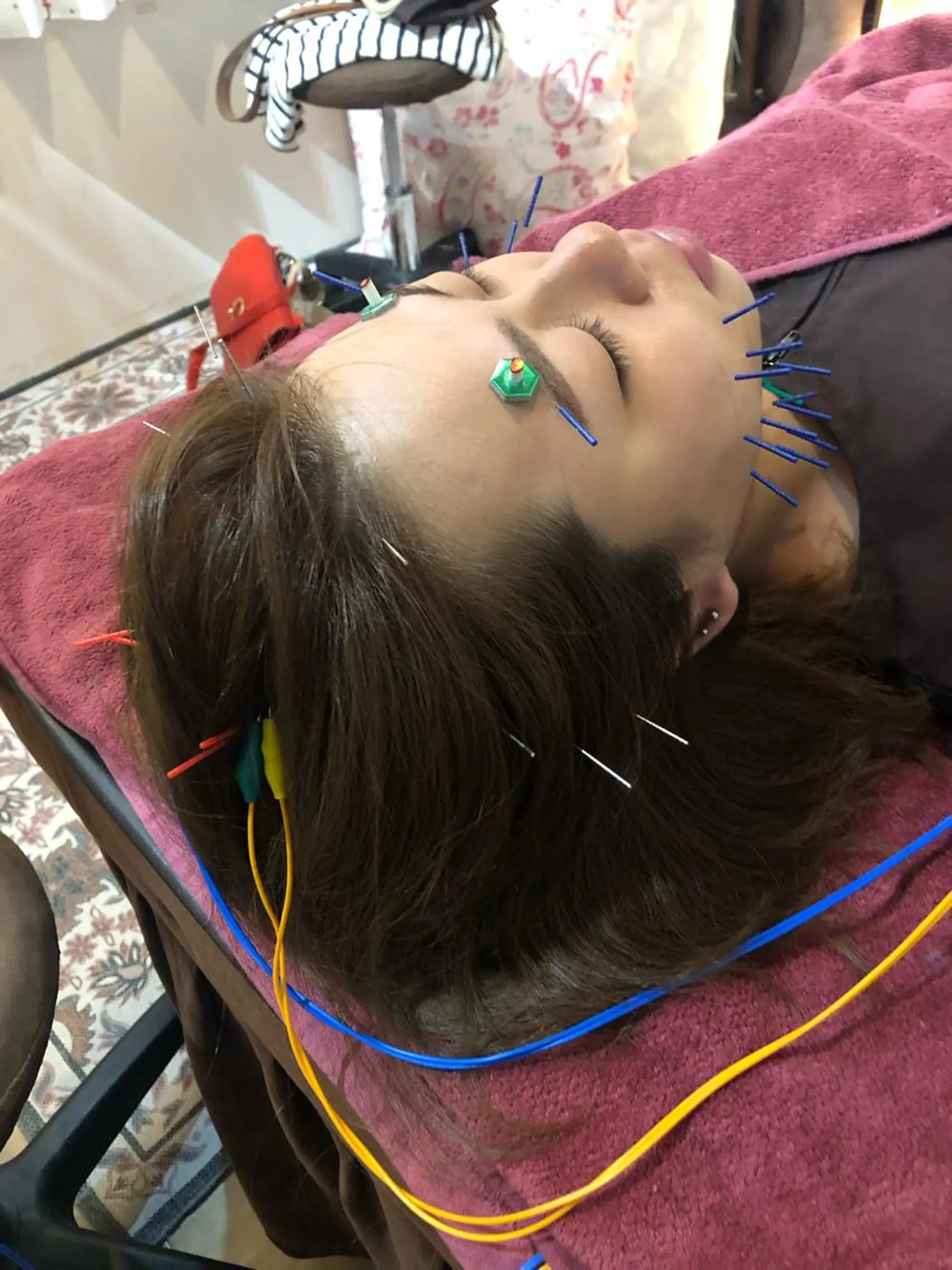 エステ リラク 美容鍼灸女性専用 りんご鍼灸治療院のその他イメージ