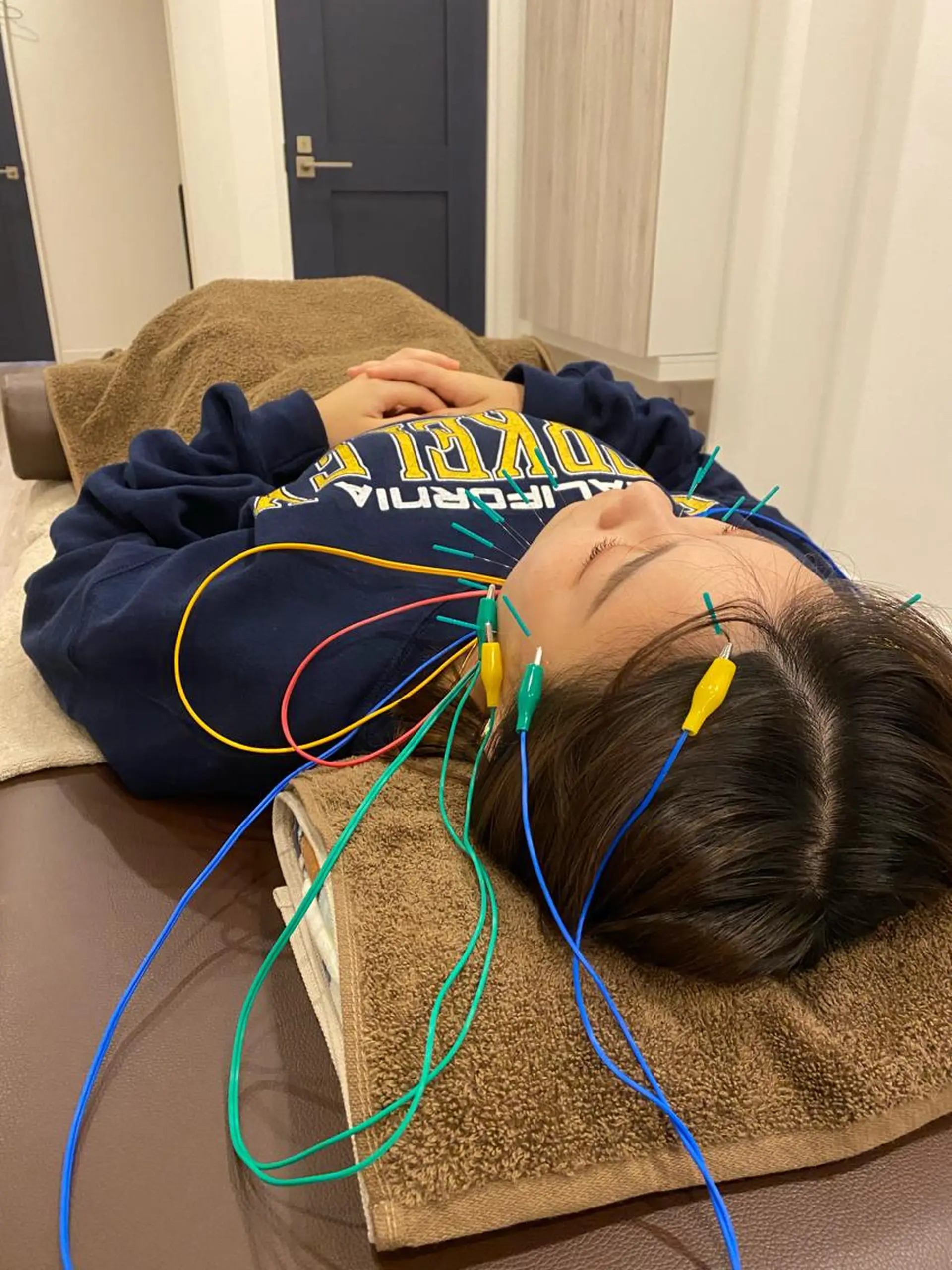 エステ リラク 肌質改善×美容鍼 ゆいのエステ・リラクイメージ