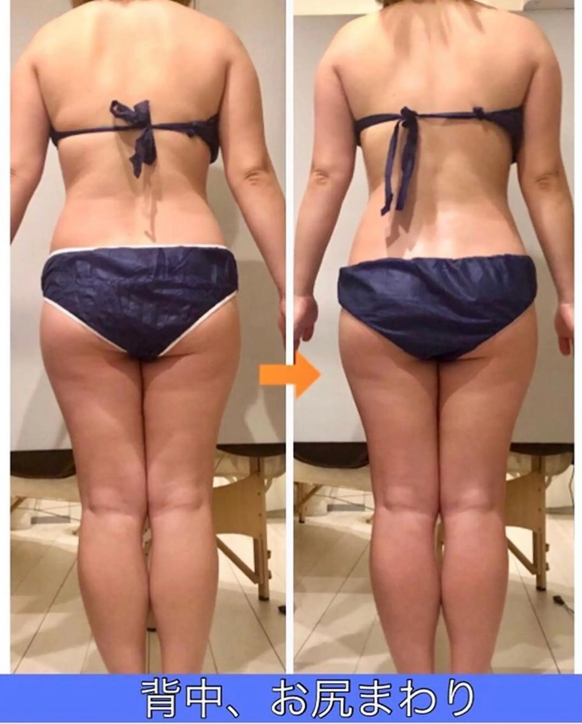 ロング カラー パーマ ヘアアレンジ メンズ キッズ ネイル マツエク・マツパ ‍痩身＆ボディ 結果出し🌟丹野のエステ・リラクイメージ