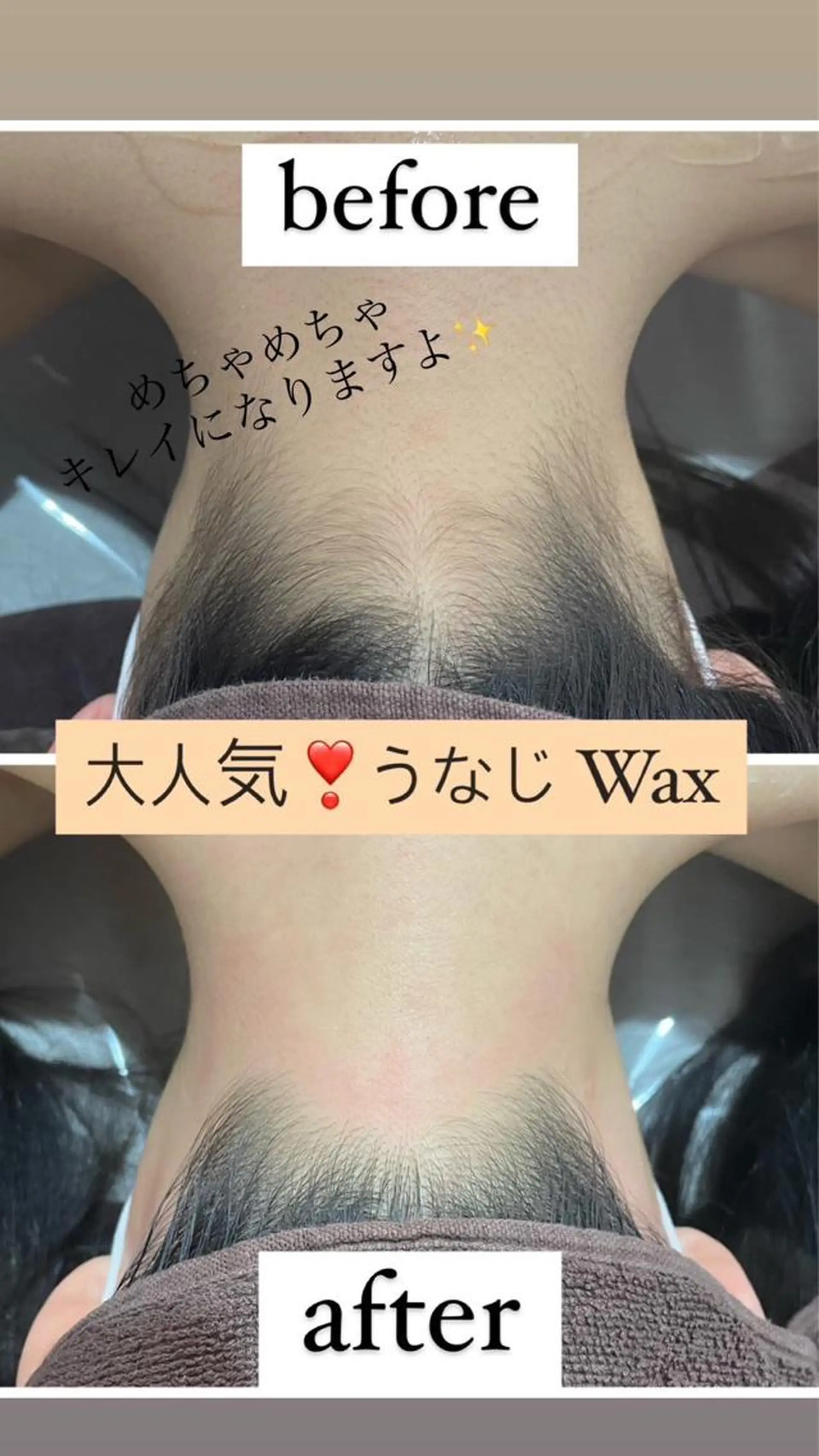 脱毛 脱毛美容サロン1st ピーリング/ワックスのエステ・リラクイメージ