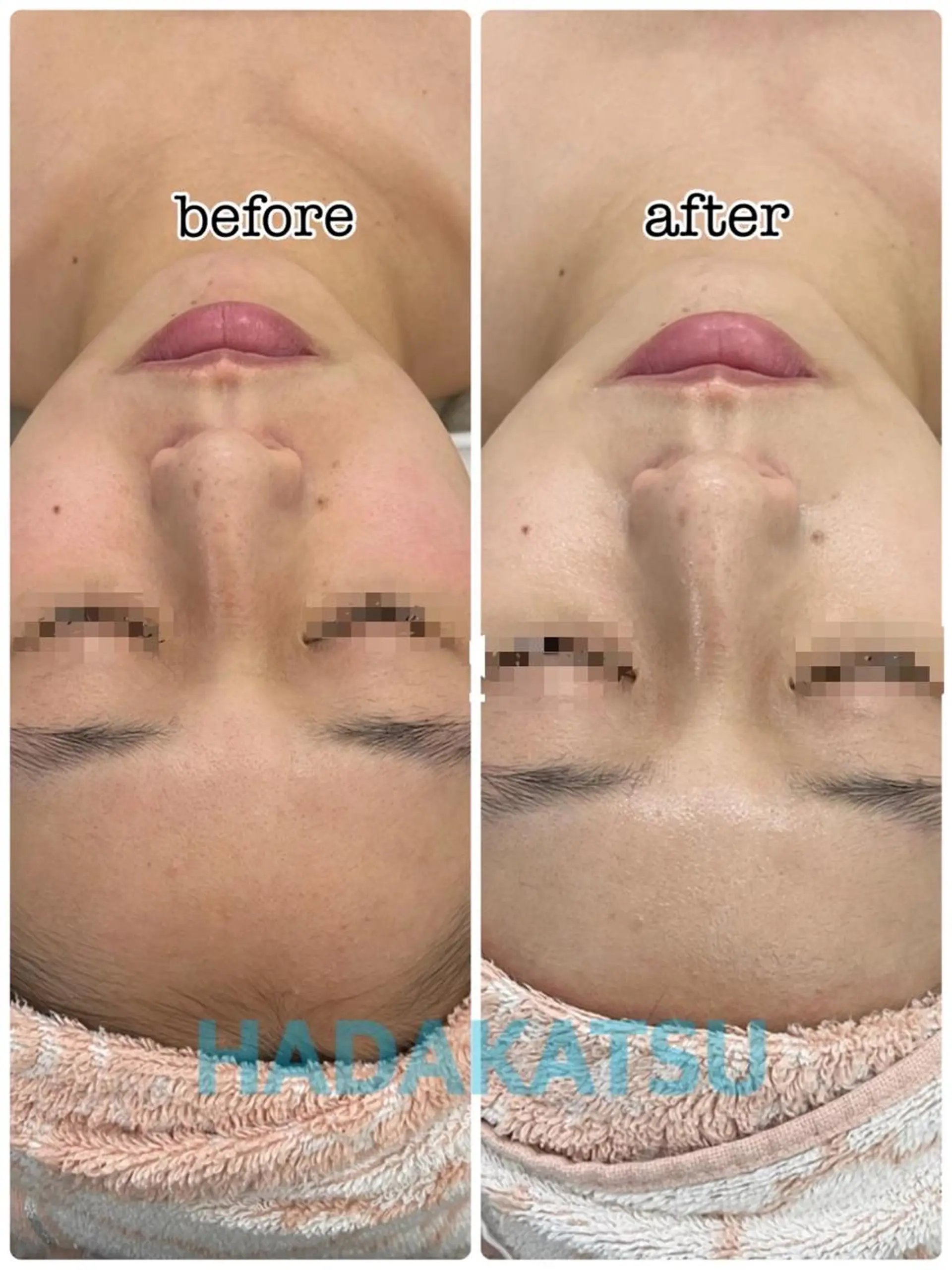 エステ 総合エステサロン 肌活のエステ・リラクイメージ