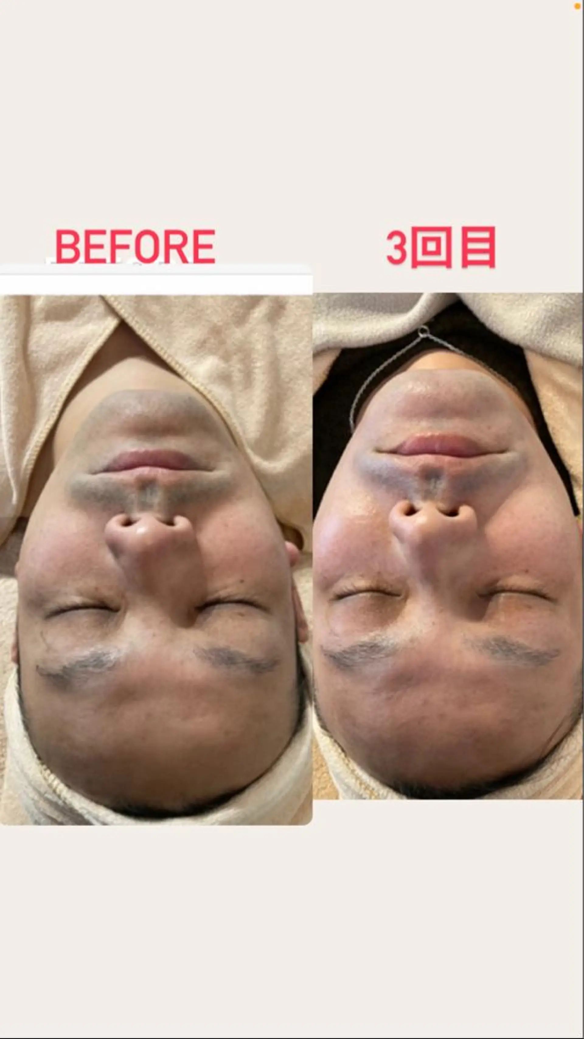 private salon Koo所属・美肌サロン Kooのその他イメージ