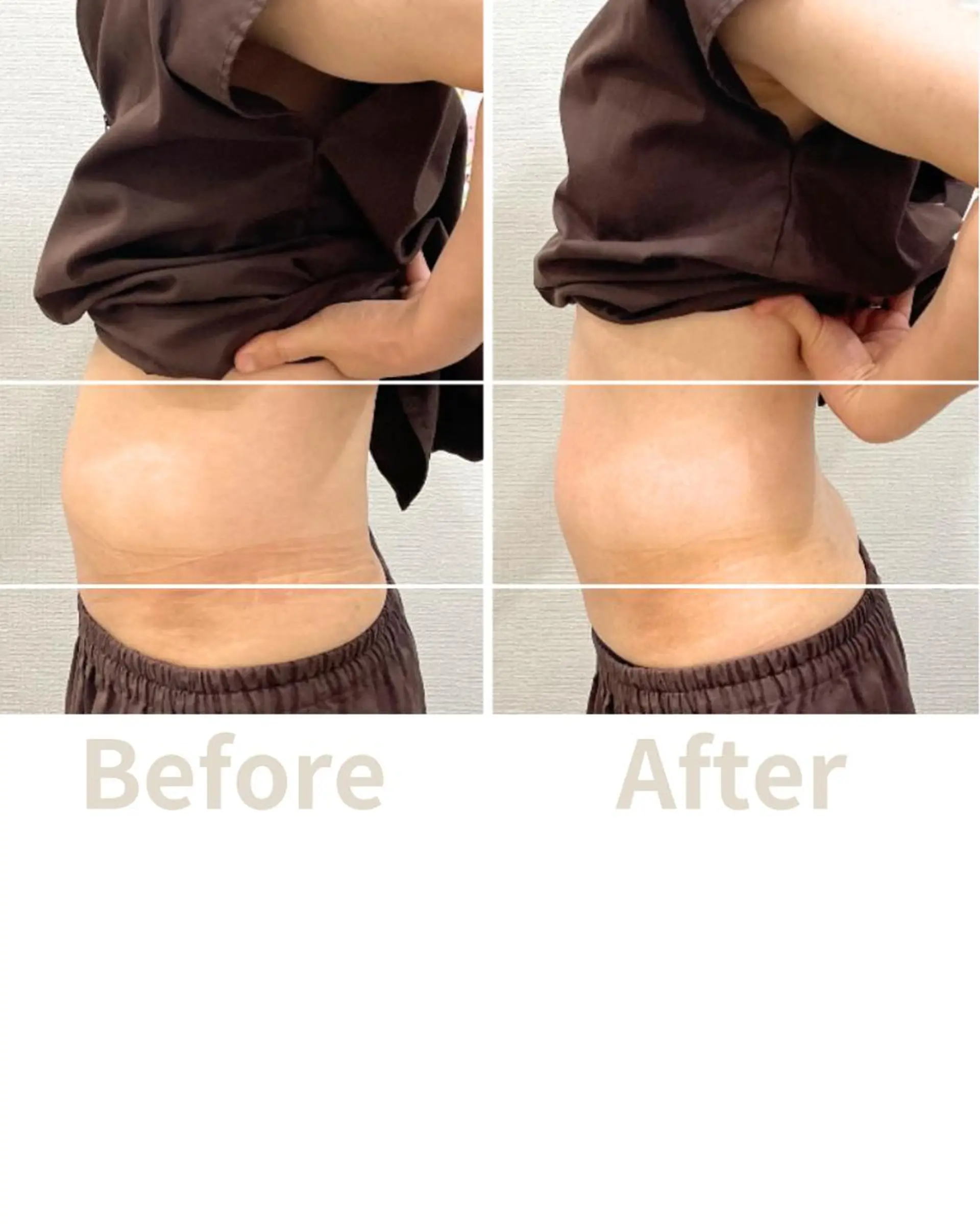 エステ リラク 【美容鍼・小顔鍼】 鍼灸師　吉田洋美のエステ・リラクイメージ