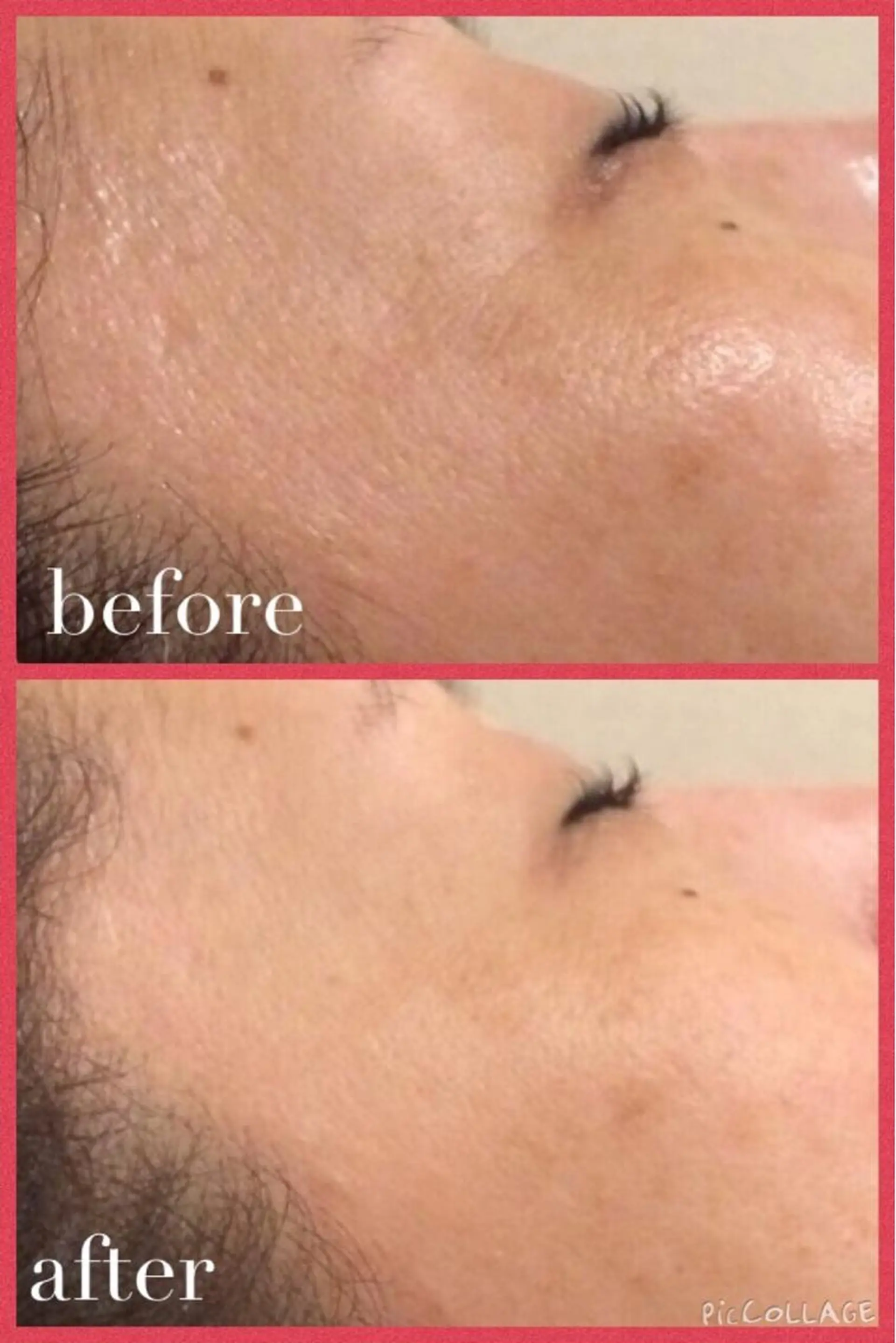 メンズ キッズ 金の糸脱毛 産毛ケア専門のエステ・リラクイメージ