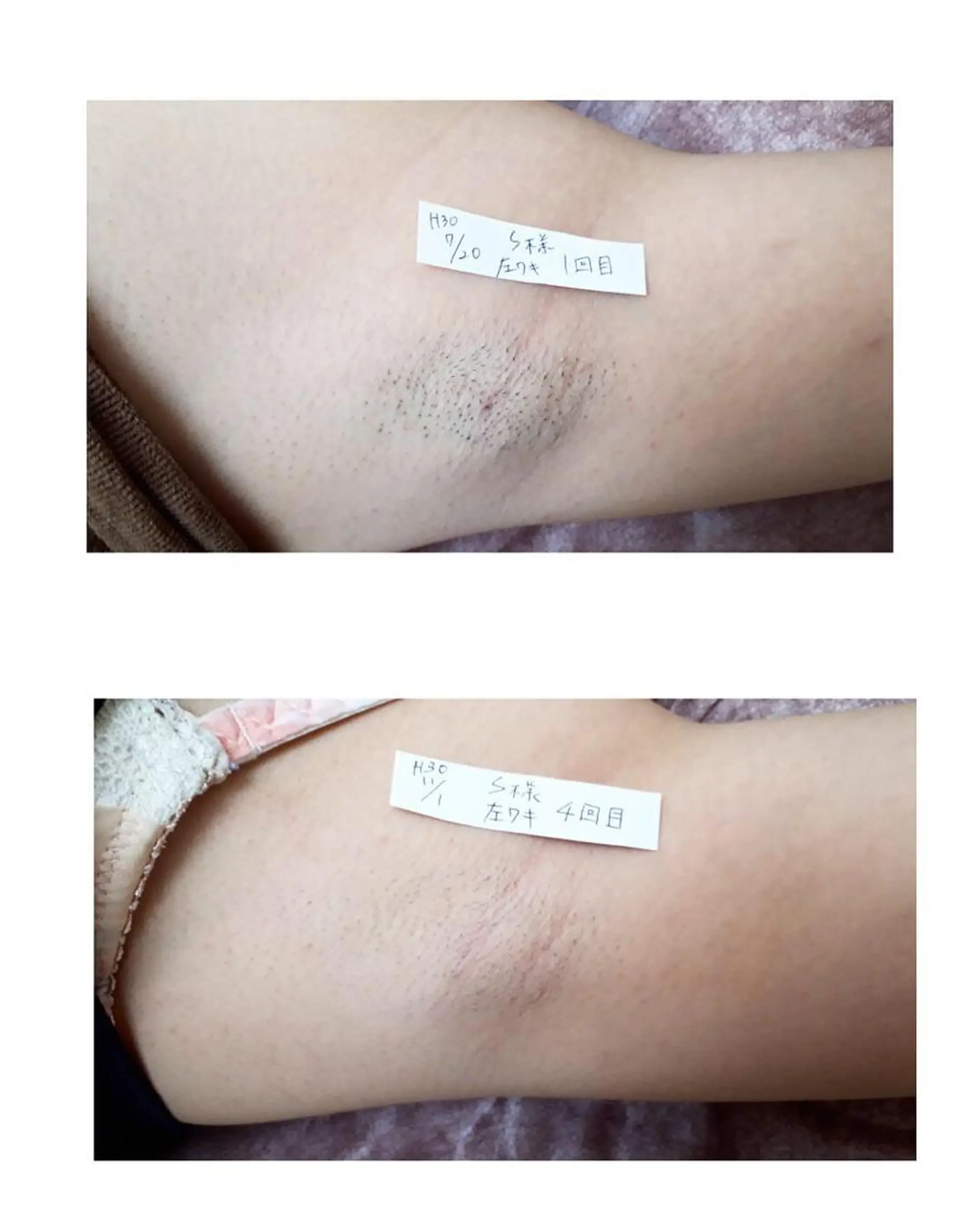 脱毛 Prima 痩身脱毛 にごうかおりのエステ・リラクイメージ