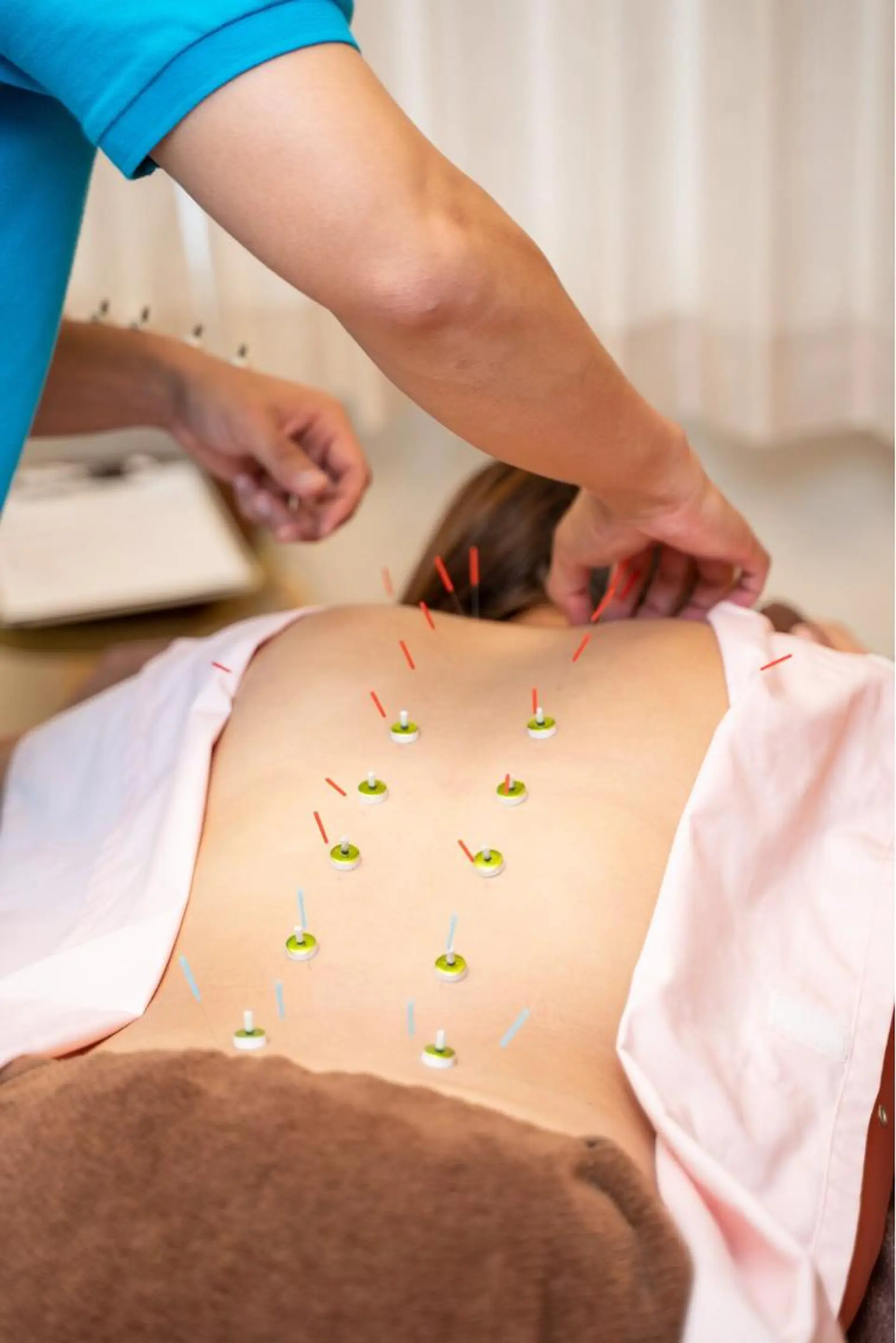 小顔ハーブピーリング 美容鍼/毛穴洗浄のエステ・リラクイメージ