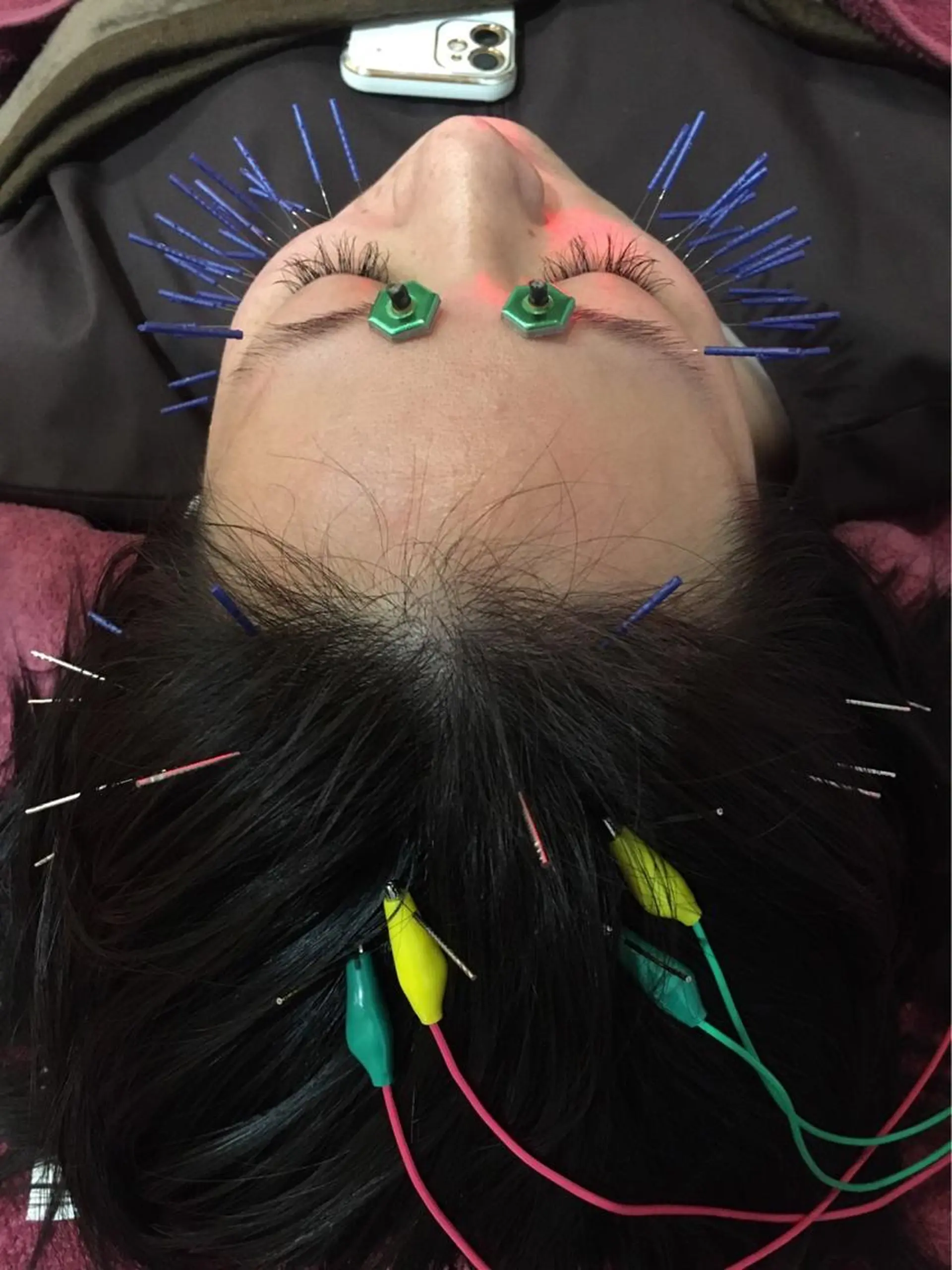 エステ リラク 美容鍼灸女性専用 りんご鍼灸治療院のその他イメージ