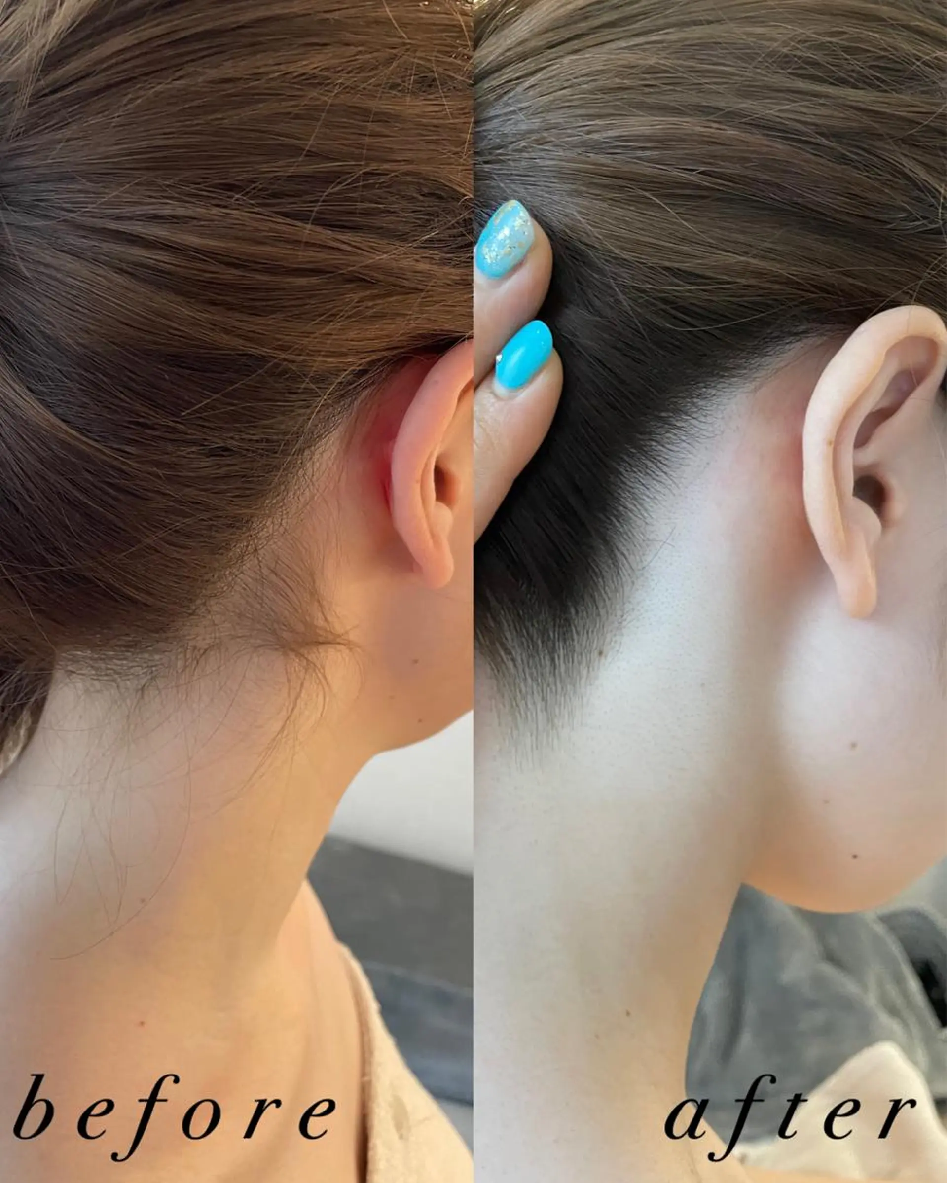 うなじ脱毛/美肌脱毛 LABELのエステ・リラクイメージ