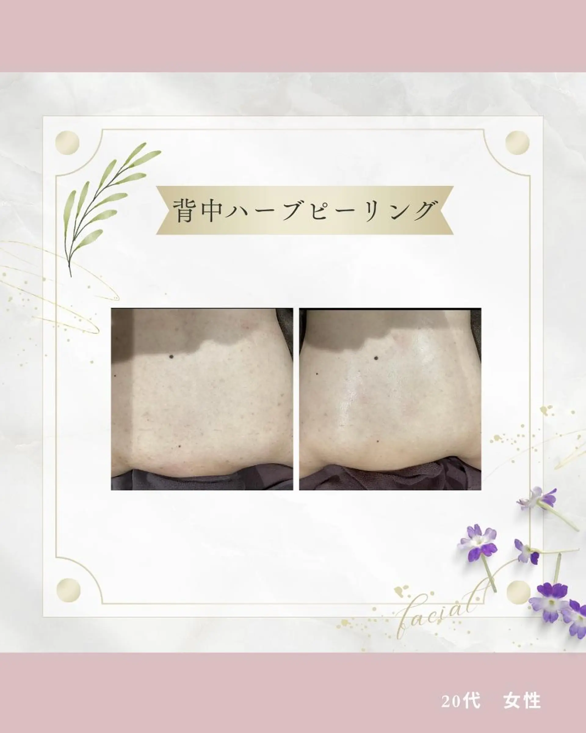 《 肌質×美肌 》 addissimoのエステ・リラクイメージ