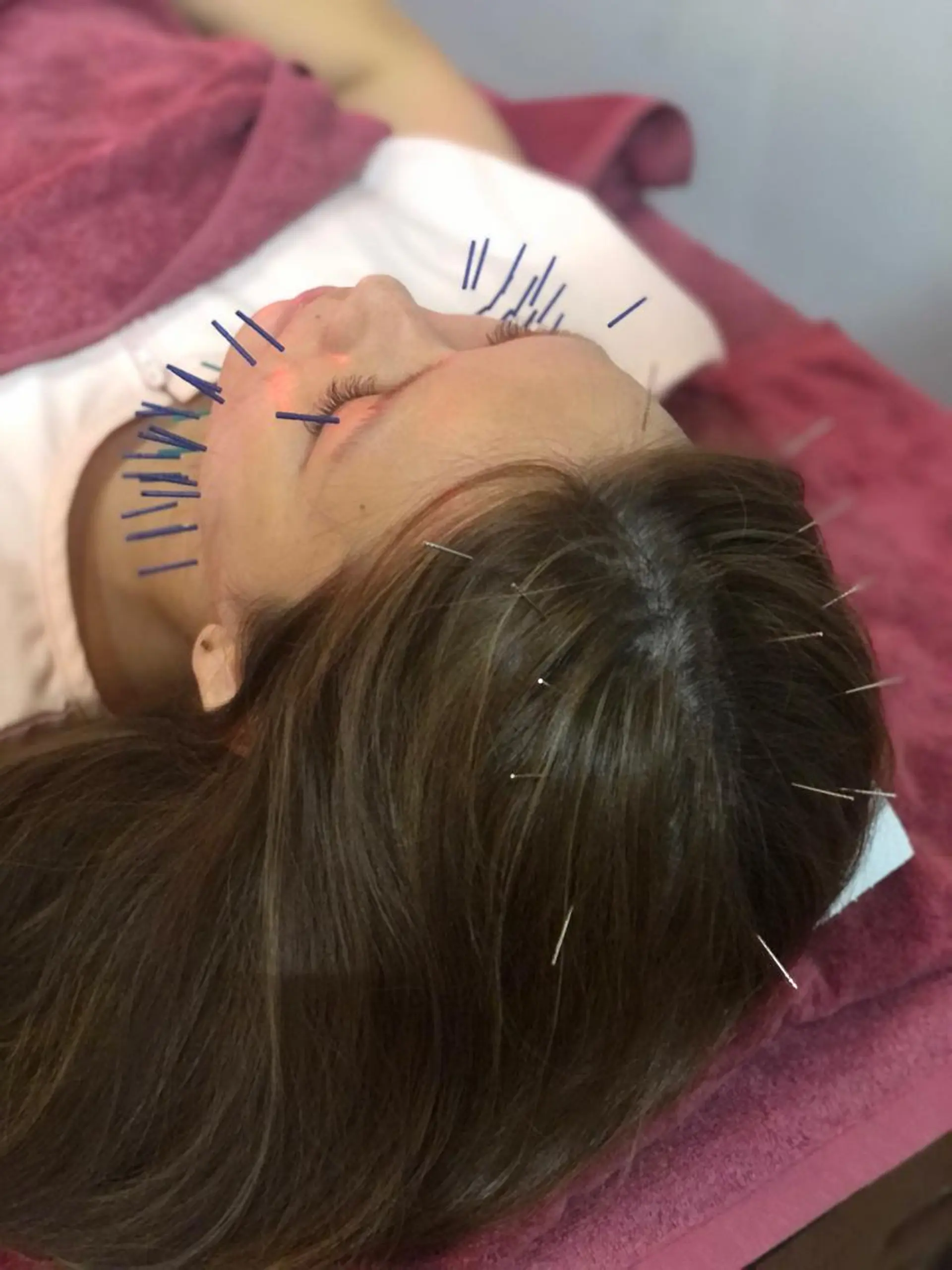 エステ リラク 美容鍼灸女性専用 りんご鍼灸治療院のその他イメージ