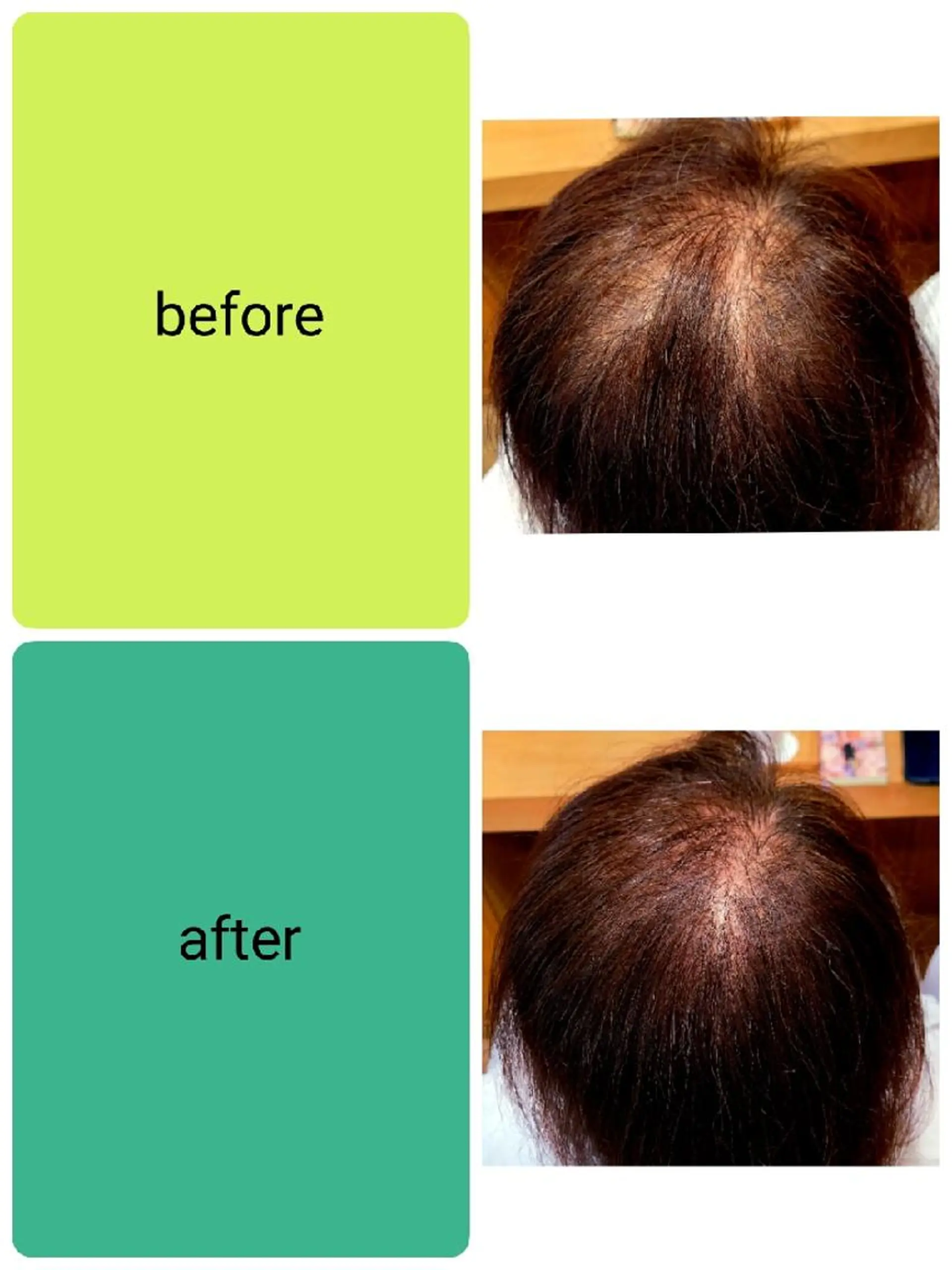 UHair吉田 /ショートヘアのヘアスタイル