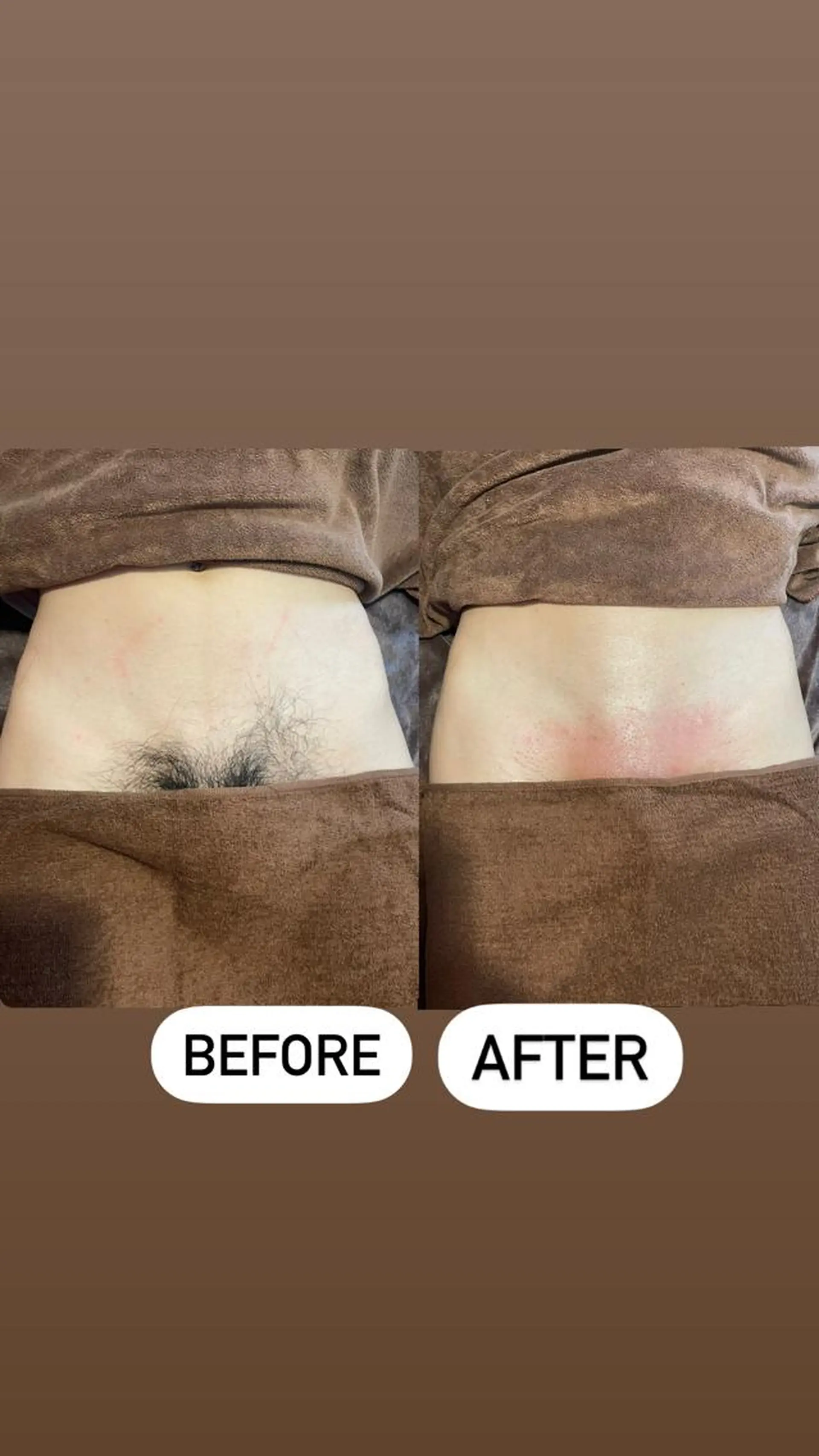 メンズ 脱毛 メンズ眉毛ITSUK Iメンズ専門　新宿の眉毛・アイブロウイメージ