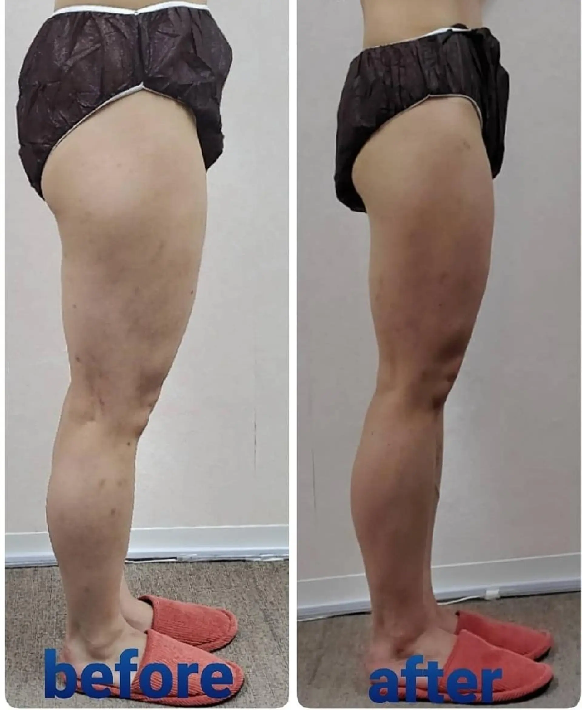 エステ リラク 【 Laforme】 ラ・フォルムのエステ・リラクイメージ