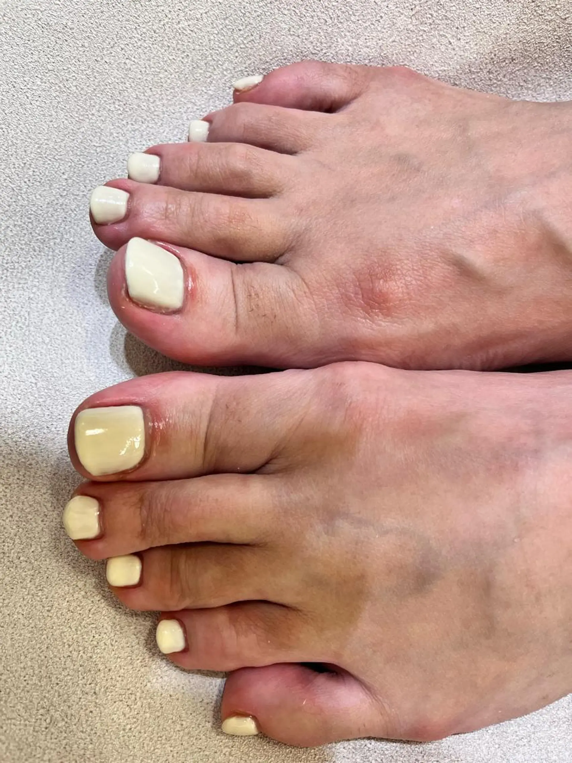 ネイル フットネイル 齋藤 英理のネイルデザイン