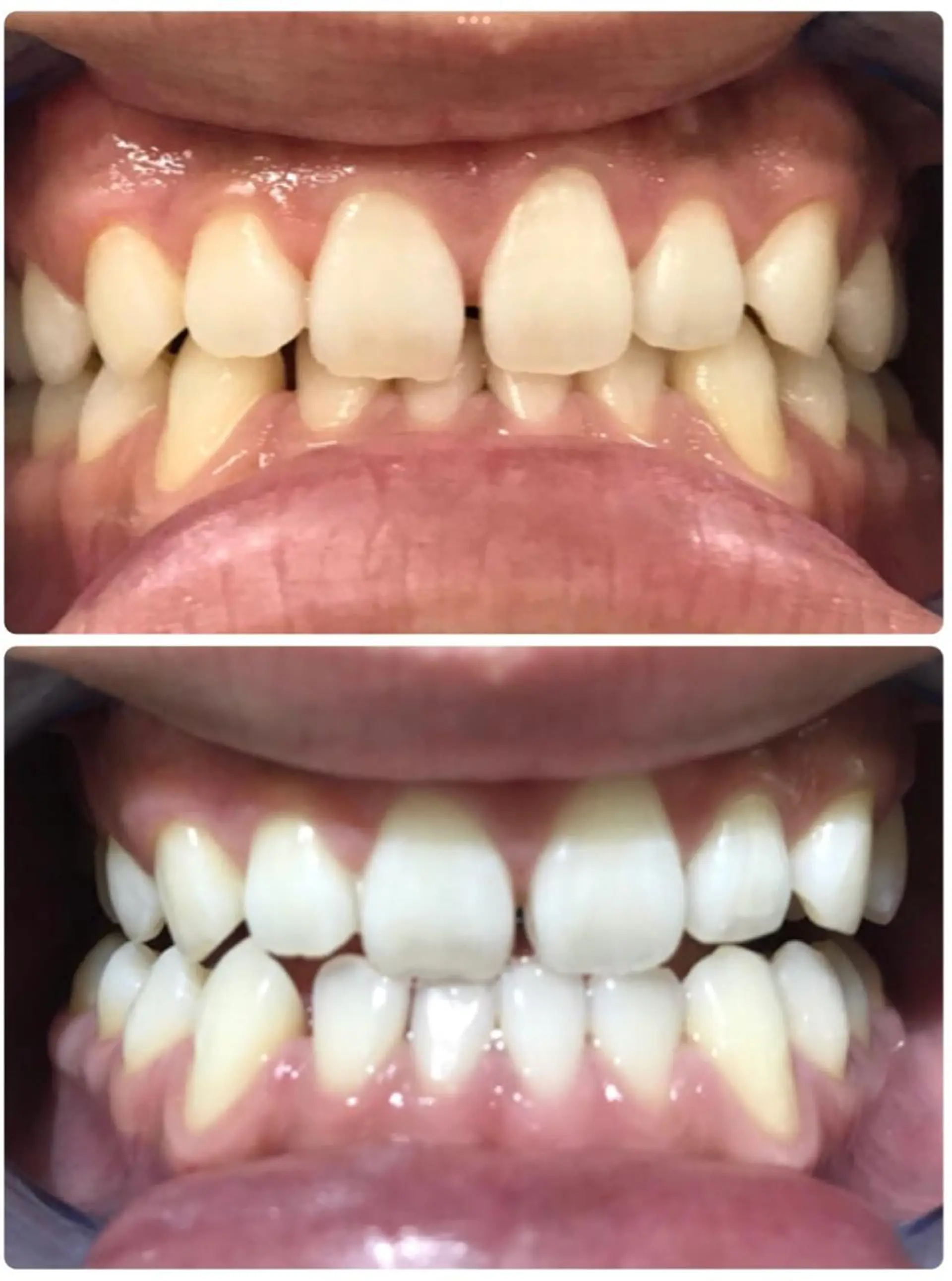 その他 Beautyサロン noel de miのエステ・リラクイメージ