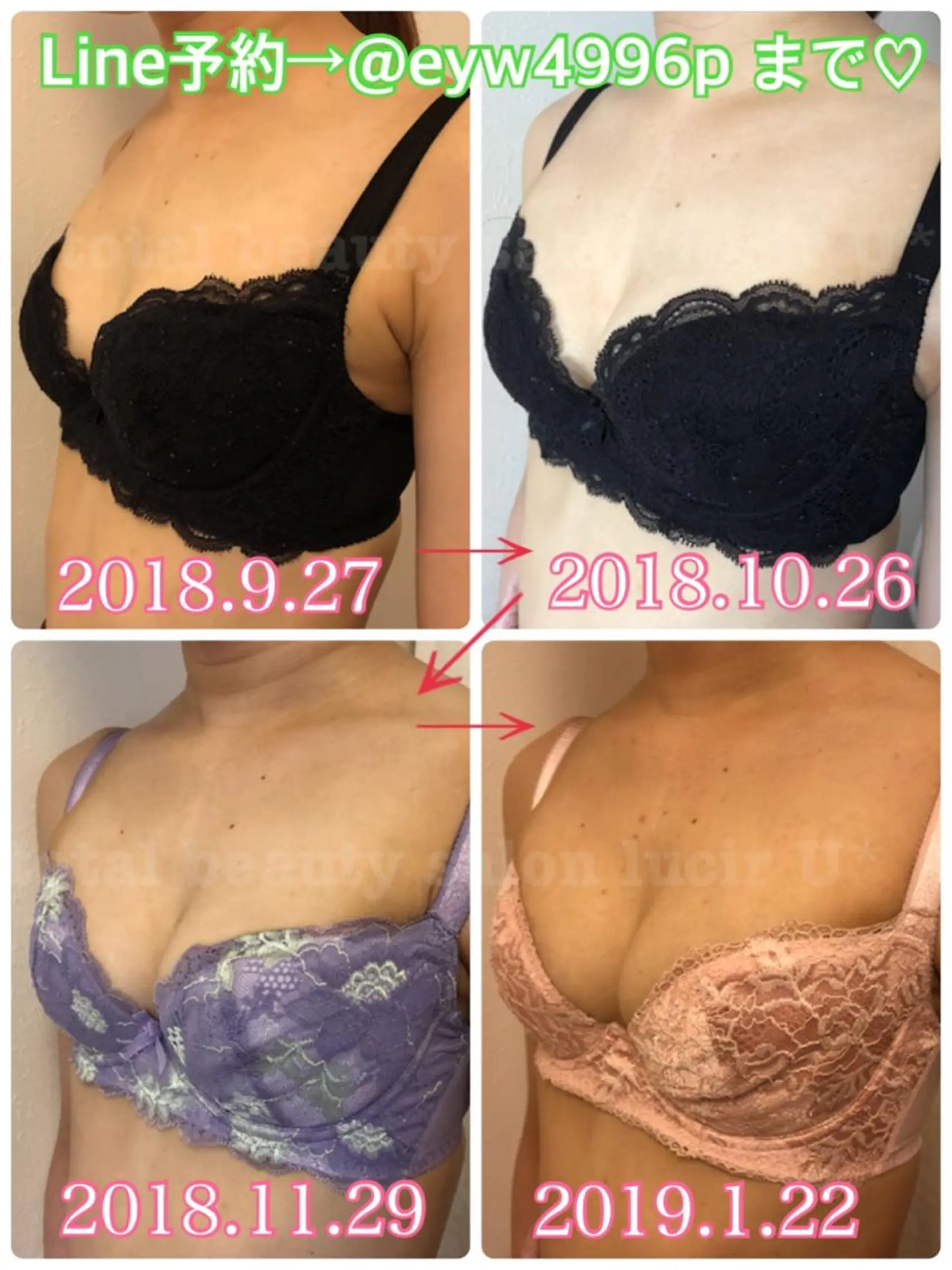 ショート カラー ヘアアレンジ メンズ キッズ マツエク・マツパ ルシール ユーのエステ・リラクイメージ