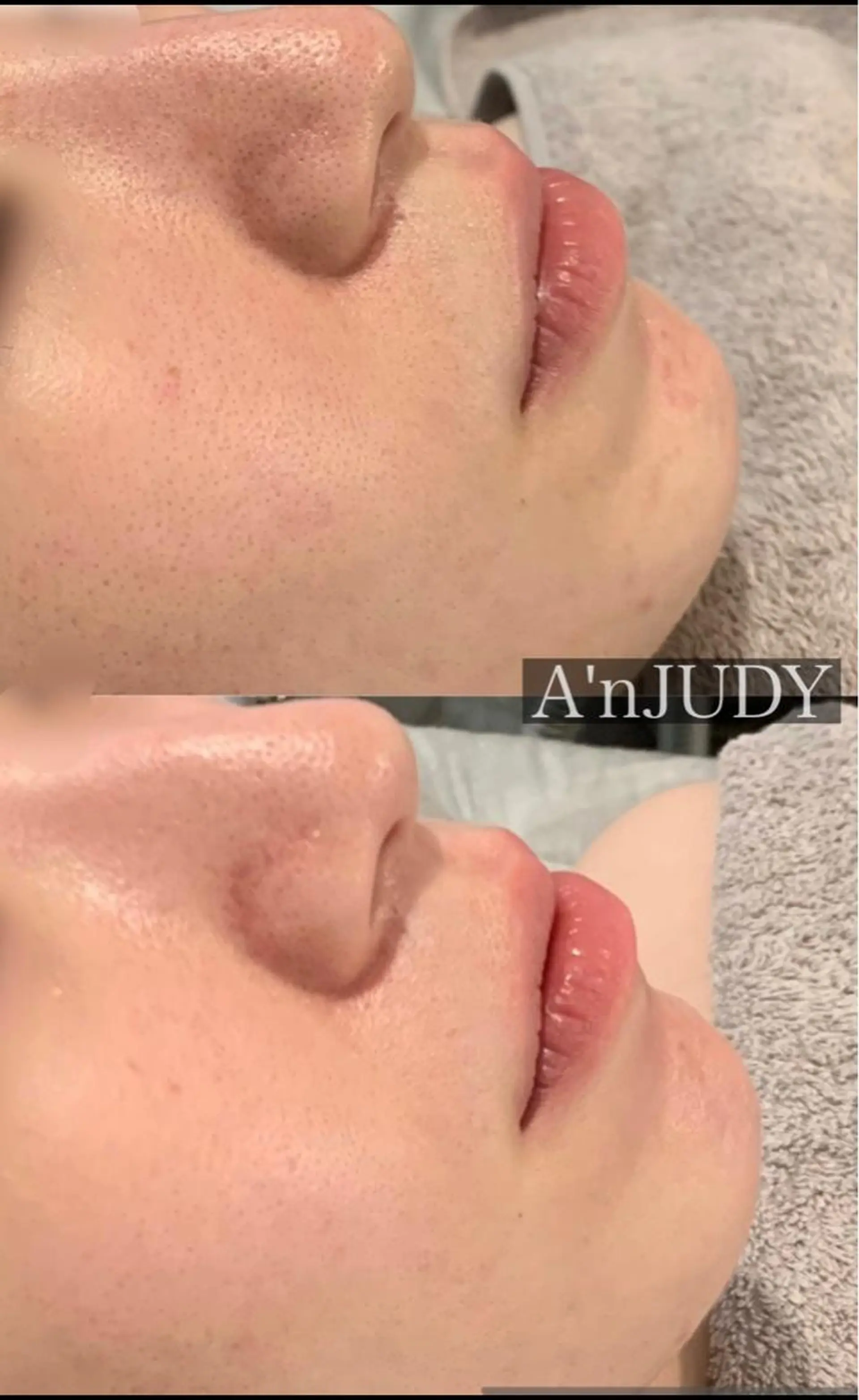 脱毛&ビューティー A'nJUDYの眉毛・アイブロウイメージ