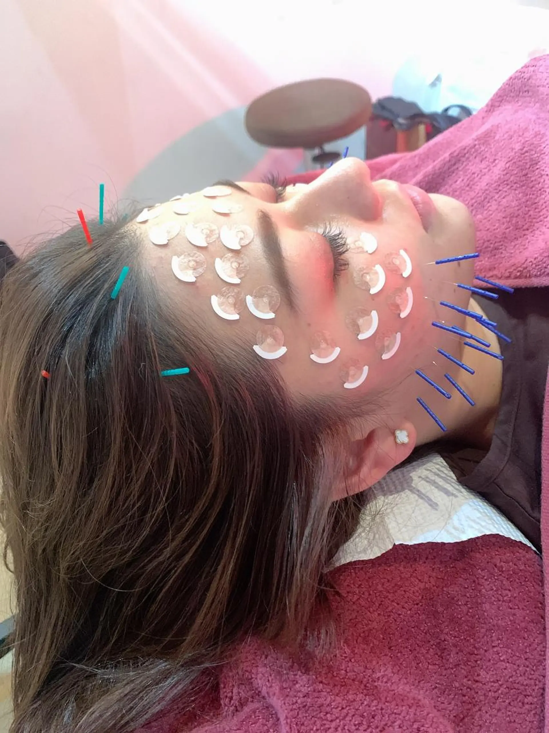 美容鍼灸女性専用 りんご鍼灸治療院のその他イメージ