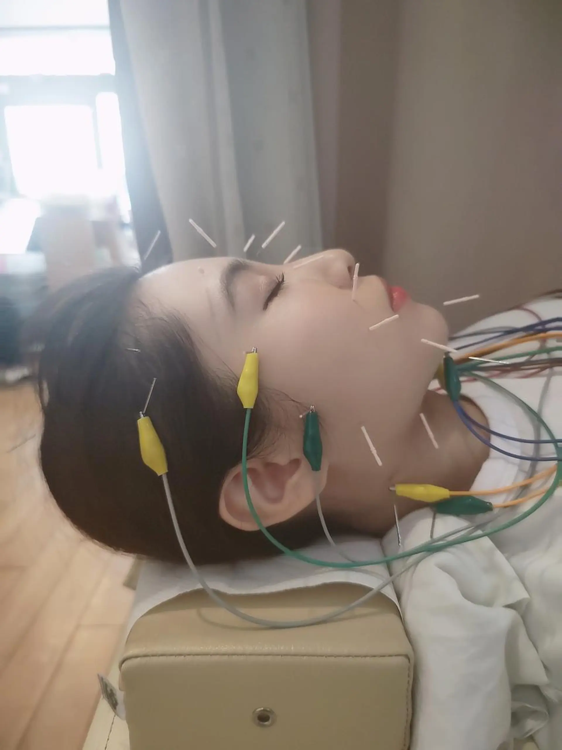 お顔のむくみたるみ 専門☆美容鍼小顔矯正のエステ・リラクイメージ