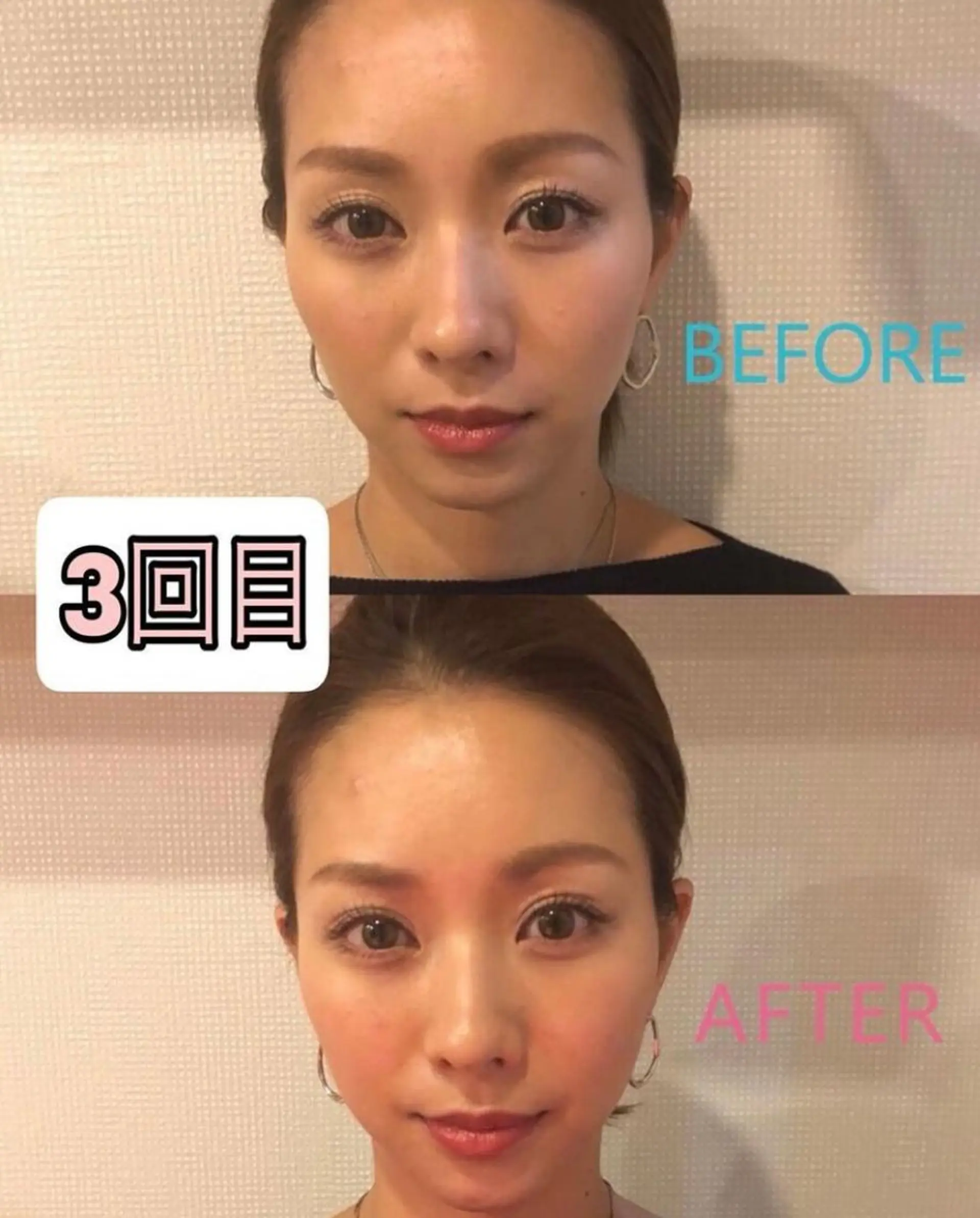 美容鍼灸サロン mahoroba院長のエステ・リラクイメージ