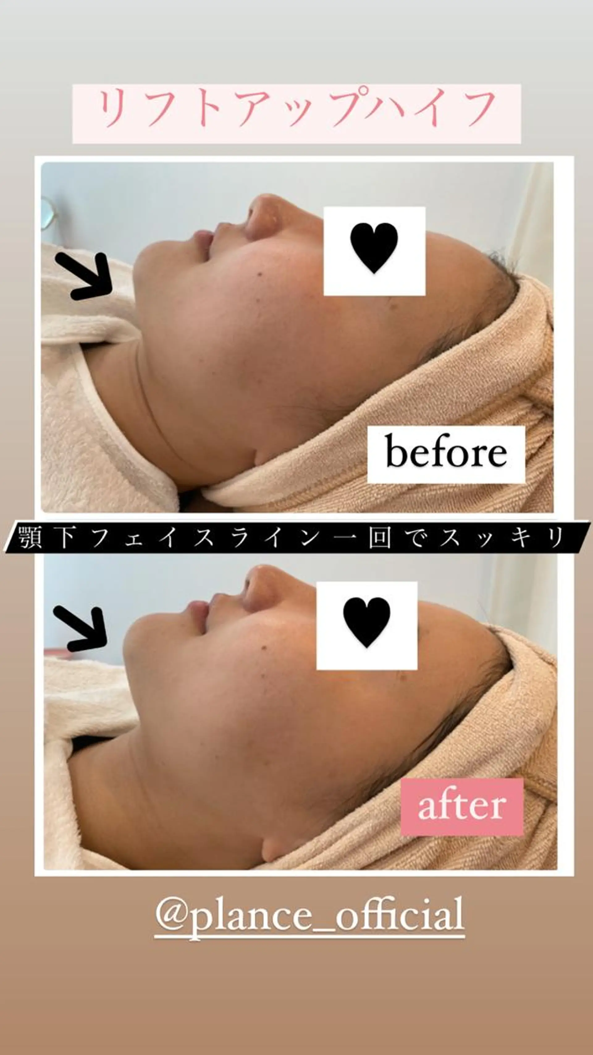 フェイシャル専門 肌質改善/プランスのエステ・リラクイメージ