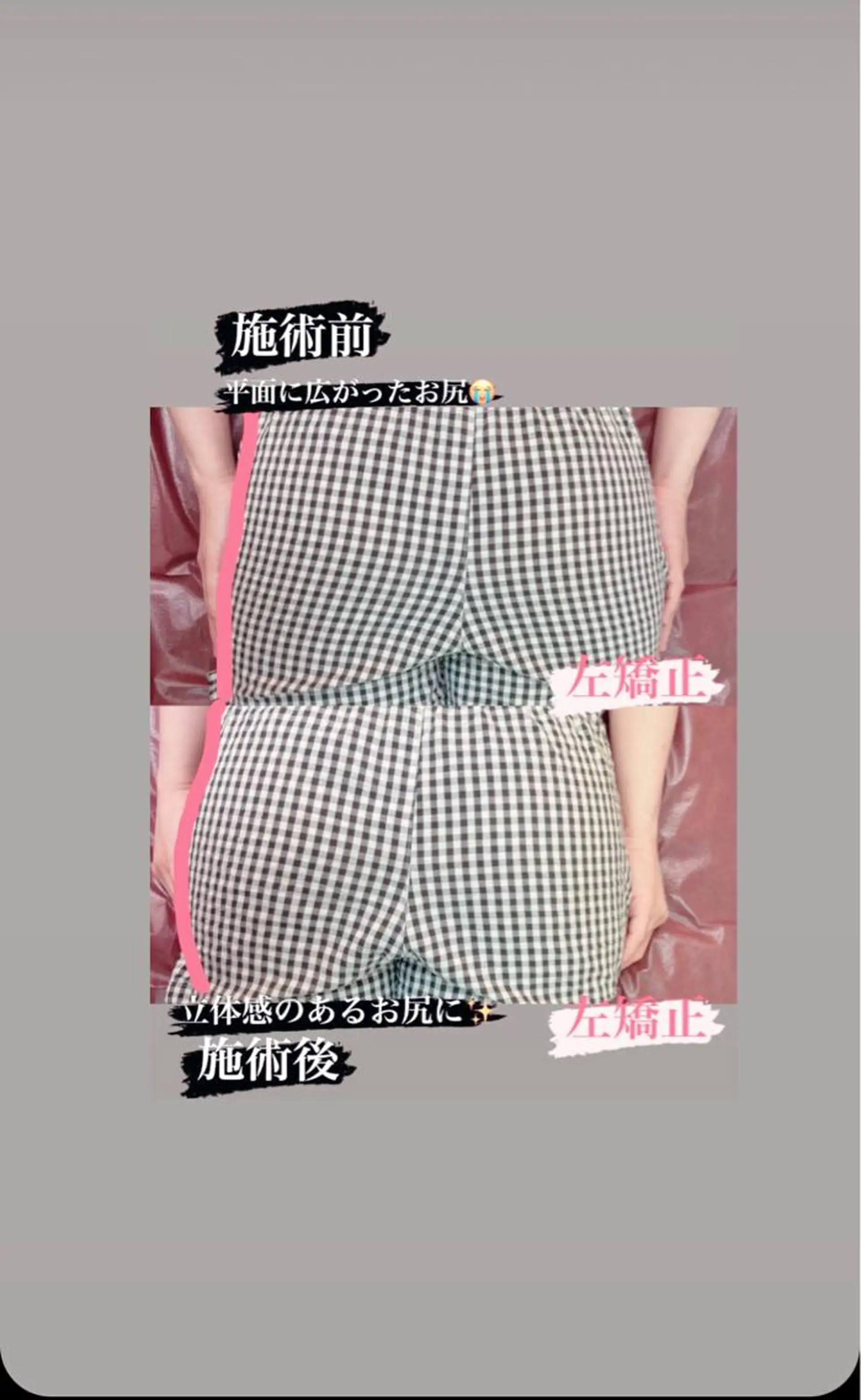 美ボディケアHacT 小池　智之のエステ・リラクイメージ