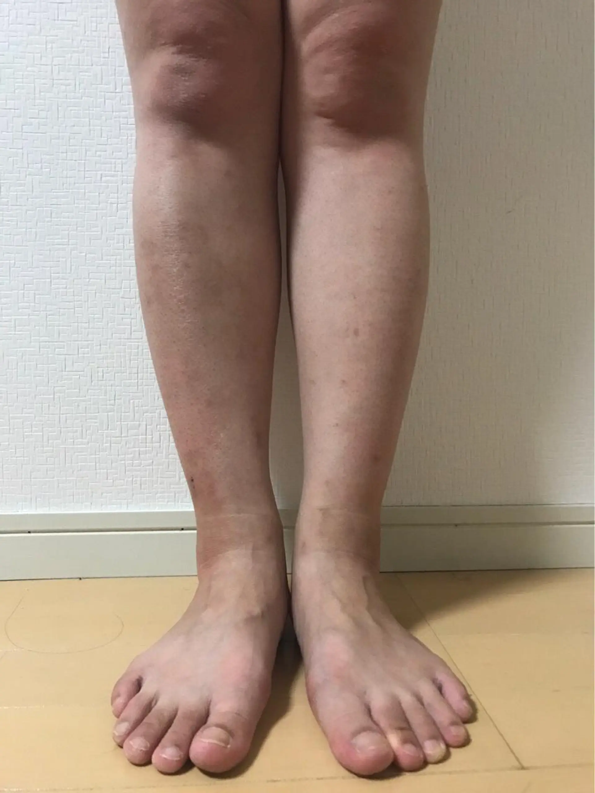 エステ リラク 粕渕 しののエステ・リラクイメージ