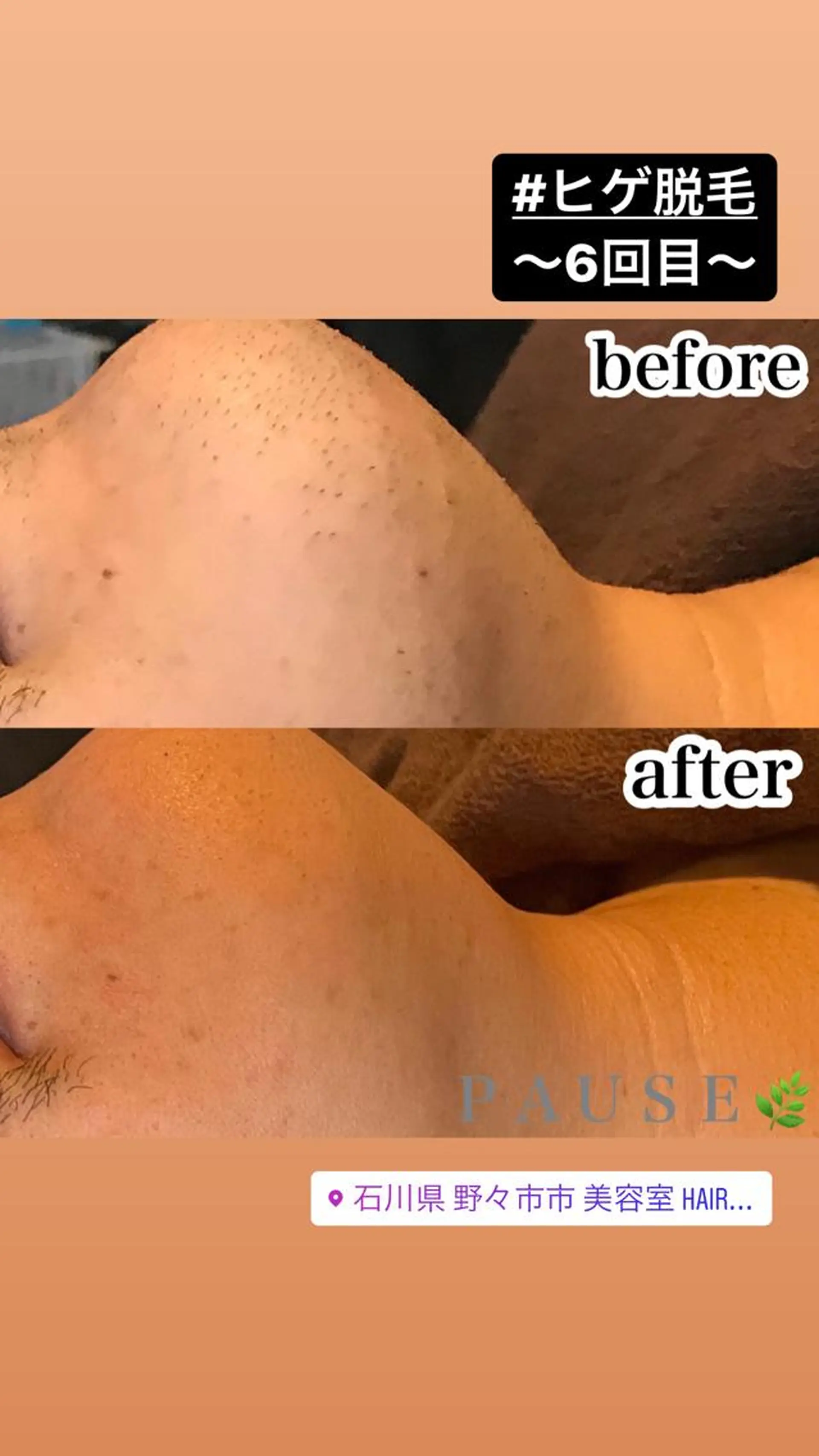 脱毛 浜野 恵美のエステ・リラクイメージ