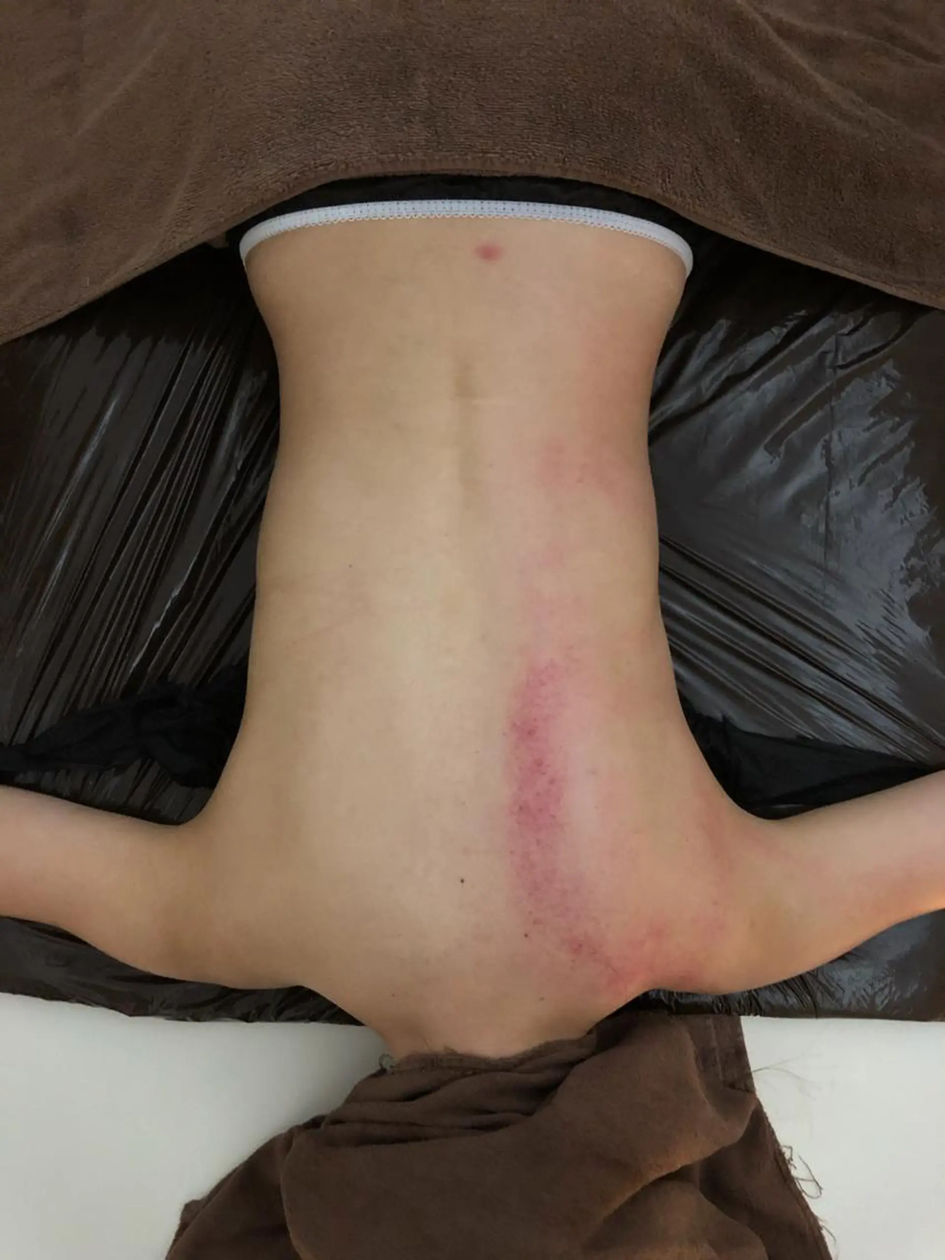 高速脱毛エステ リアンのエステ・リラクイメージ