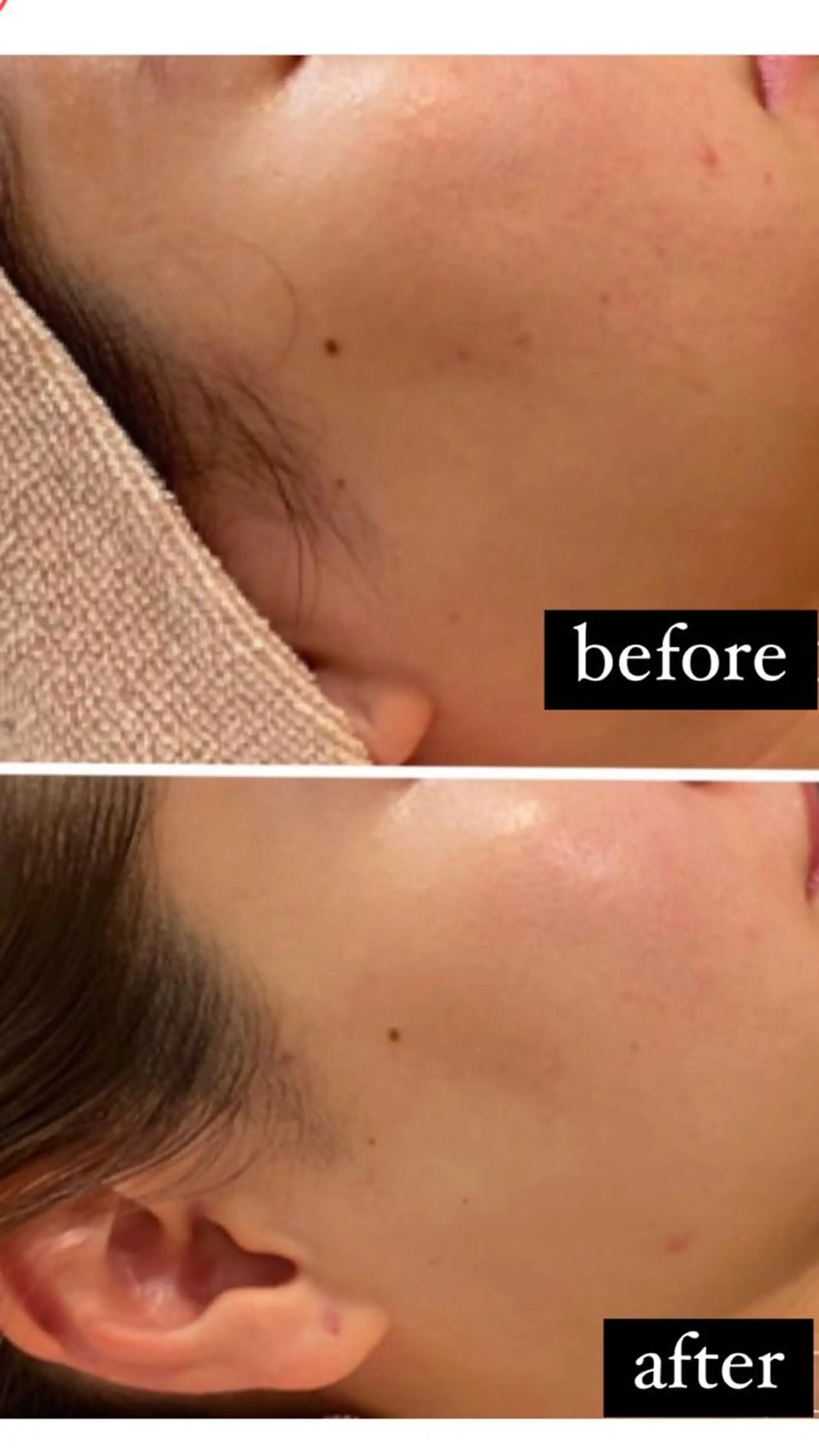 エステ 韓国系得意🦋 Aspire.のマツエク・マツパデザイン