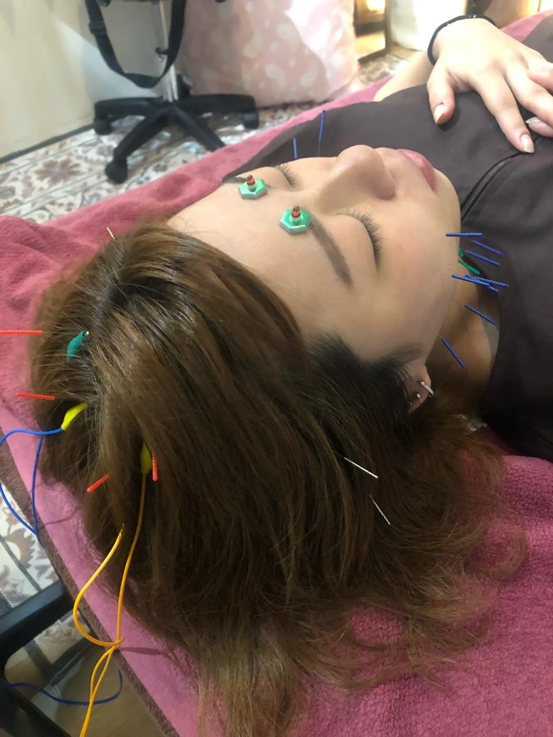 エステ リラク 美容鍼灸女性専用 りんご鍼灸治療院のその他イメージ