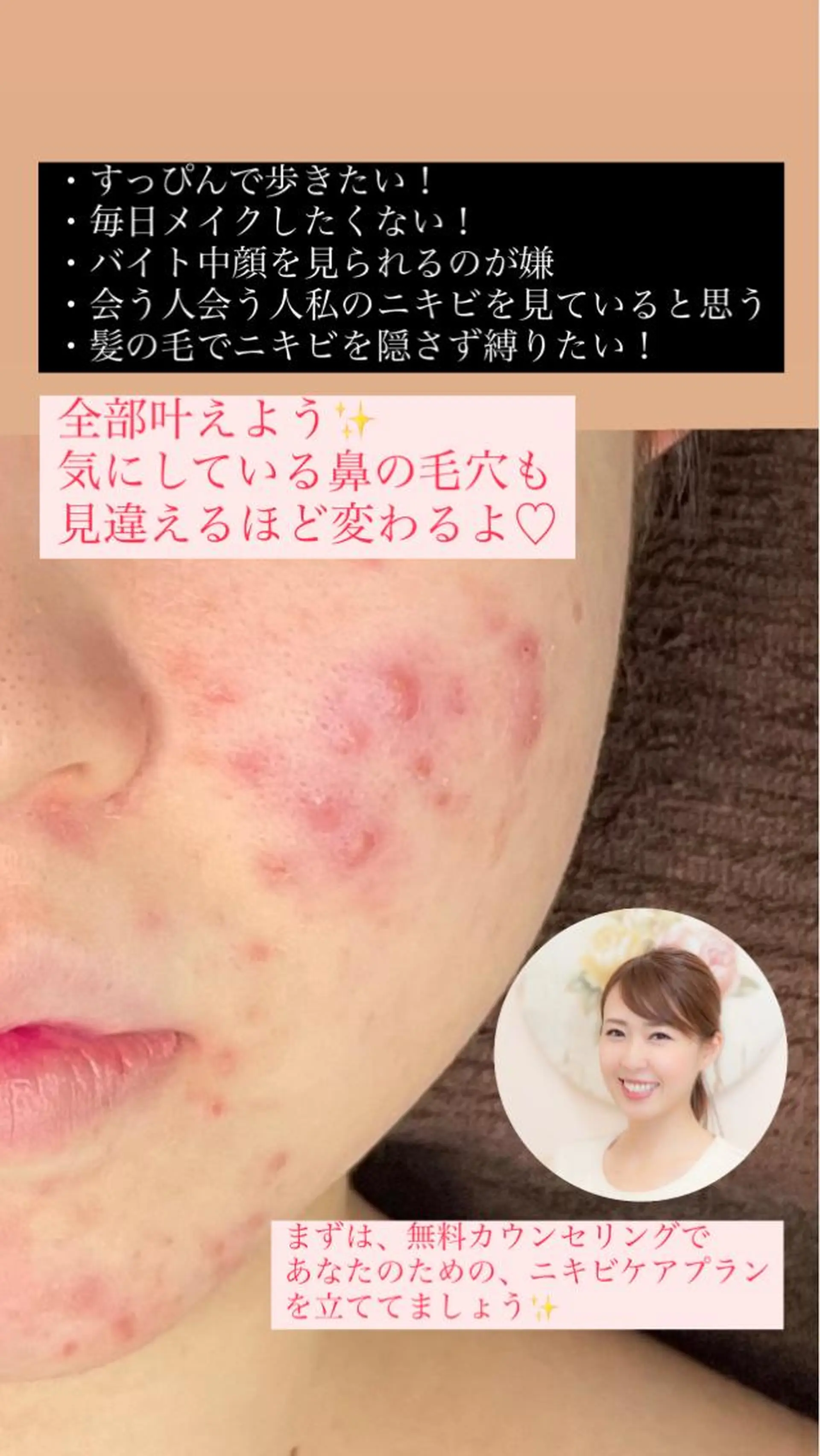 エステ ベラージュ【美背中・ 美尻・フェイシャル】のエステ・リラクイメージ