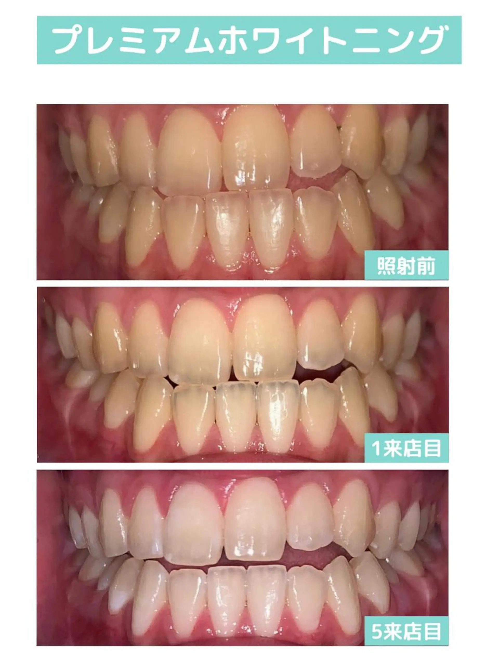 その他 韓国式3D毛穴洗浄 lonhanaのその他イメージ