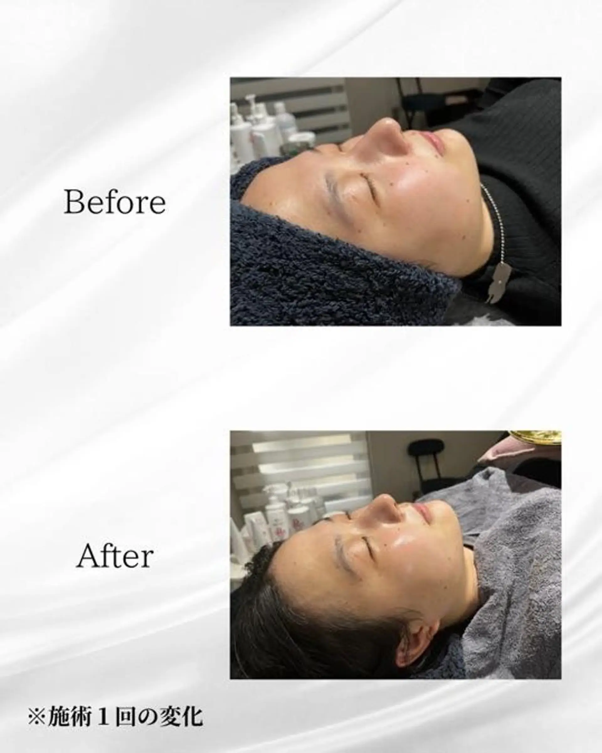 エステ ハーブピーリング🌿 REVI/Ayanoのエステ・リラクイメージ