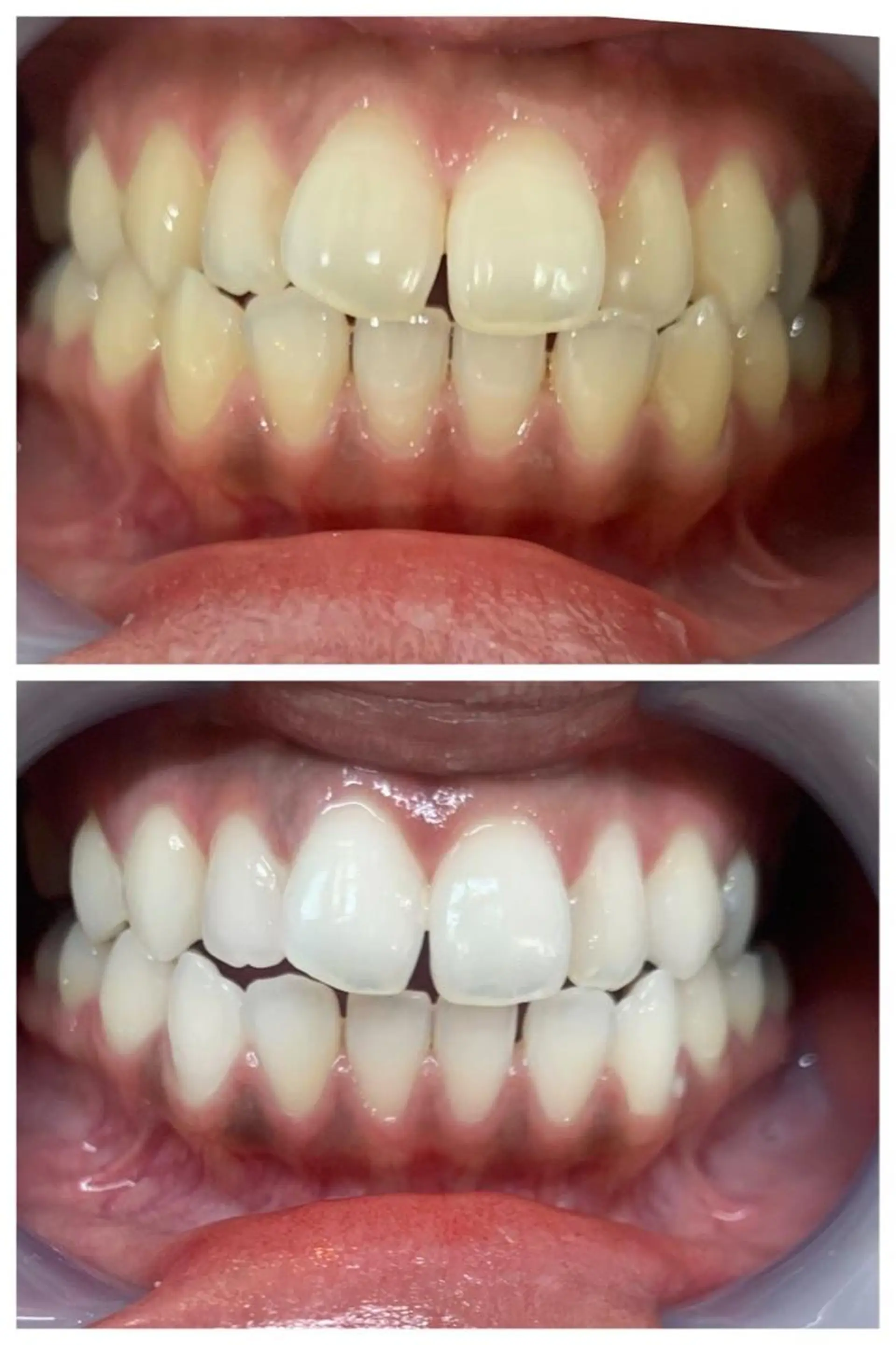 美人スイッチdiet スーパージェクションのその他イメージ