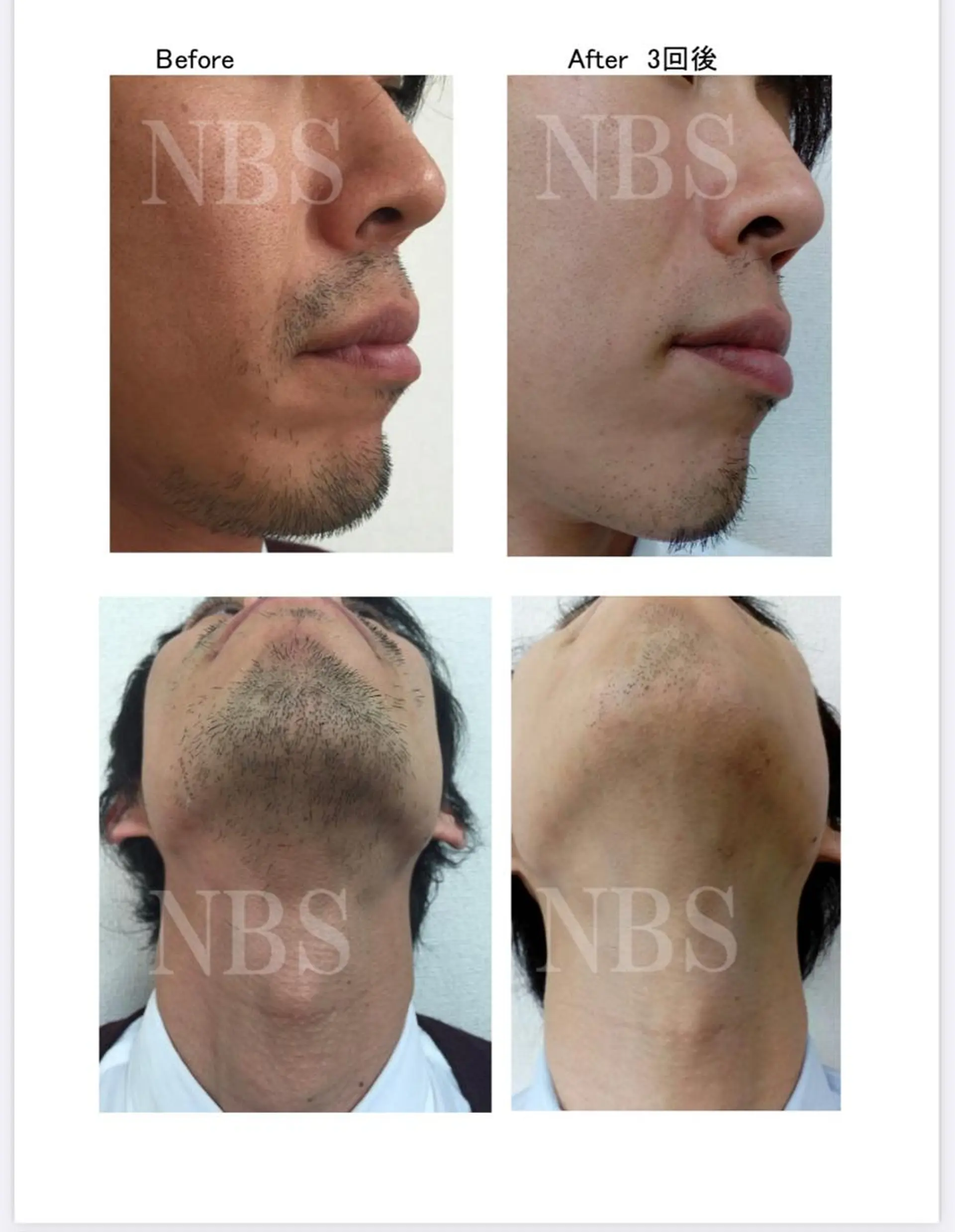 メンズ 脱毛 外山 理都子のエステ・リラクイメージ