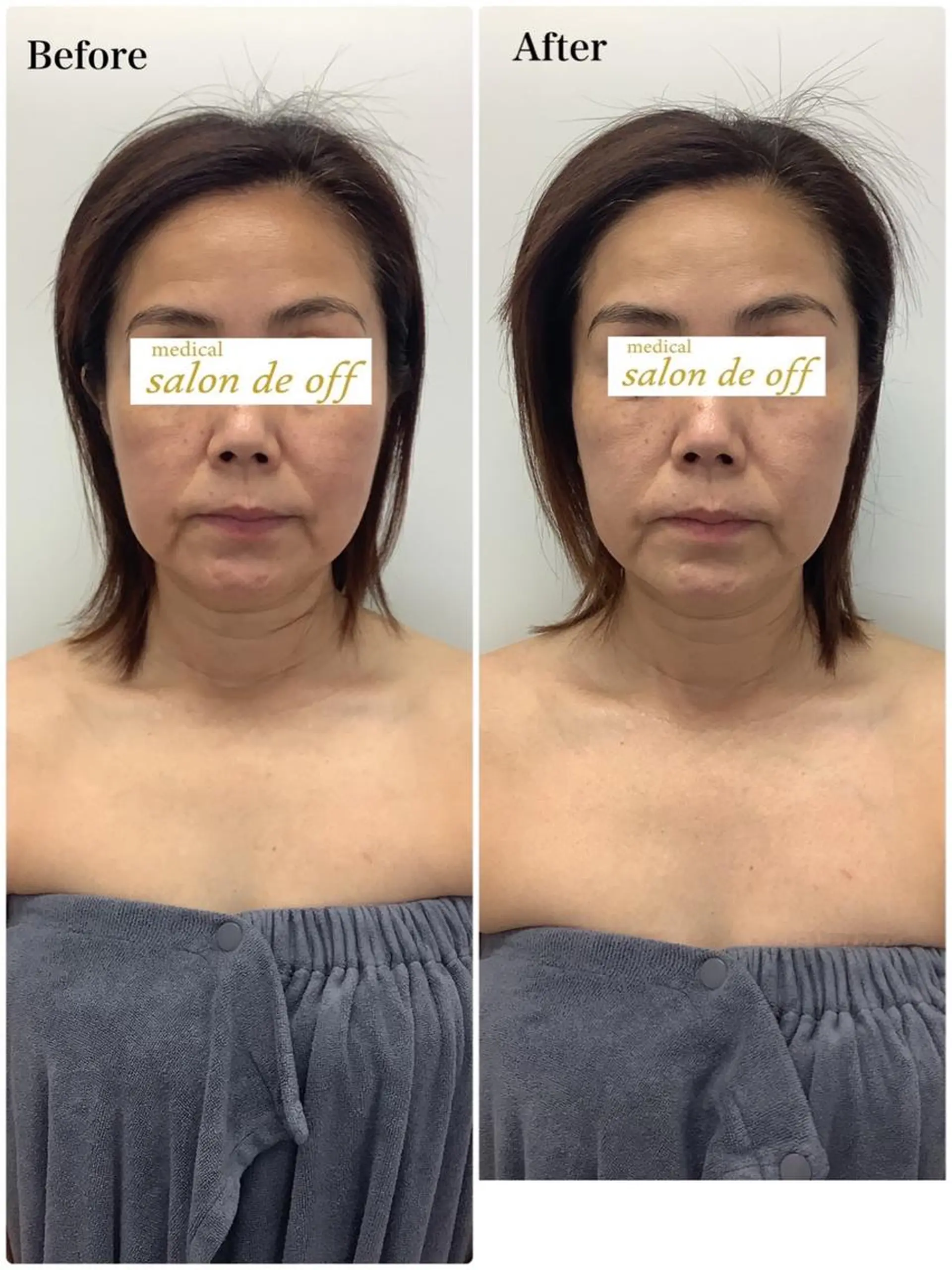 メディカルサロンドオフ所属・ハリサロンドオフ 美容鍼灸×小顔整体のエステ・リラクイメージ