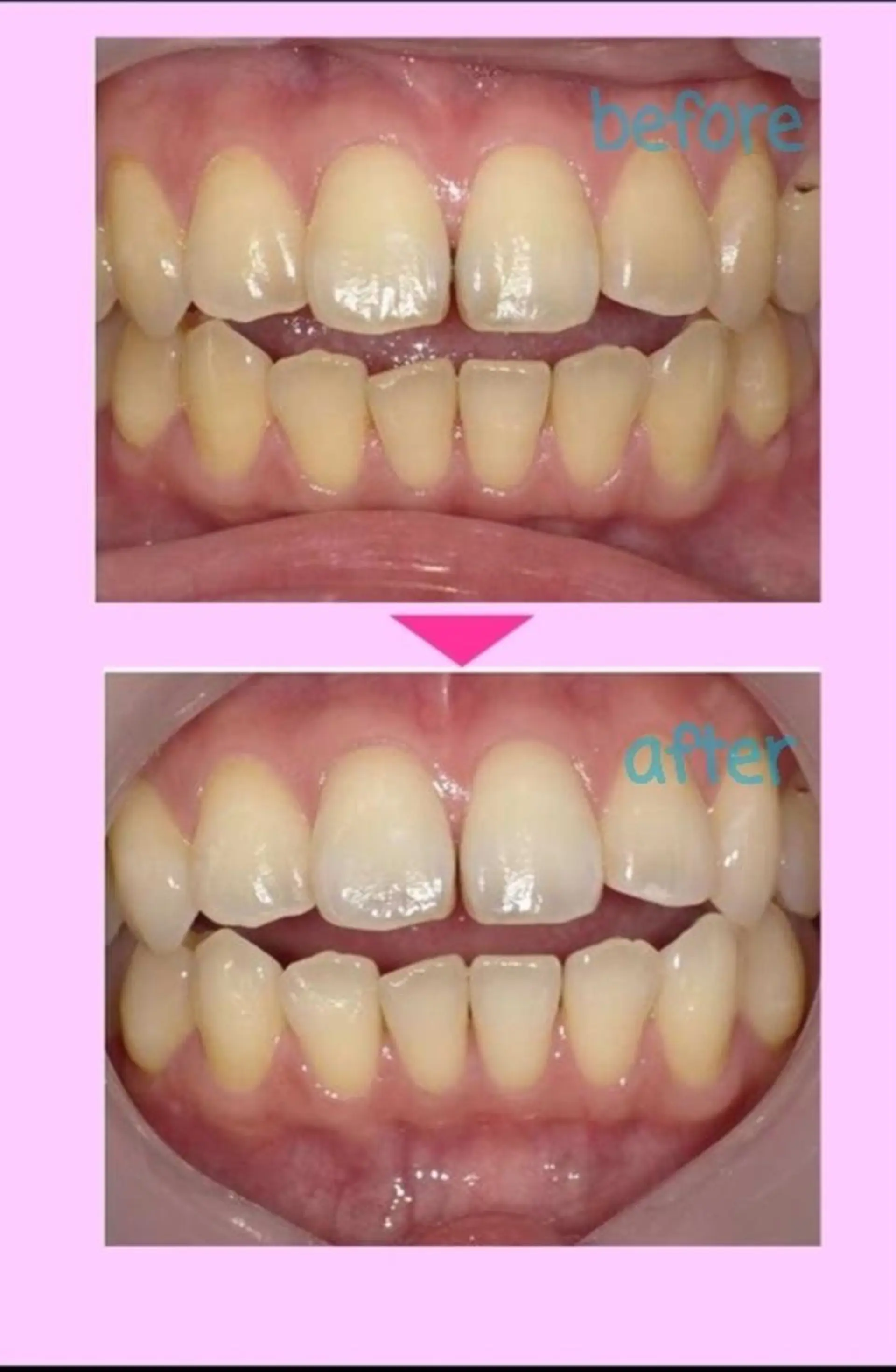 その他 セルフホワイトニング エクシア大宮東口店所属・セルフホワイトニング エクシア大宮東口店のその他イメージ