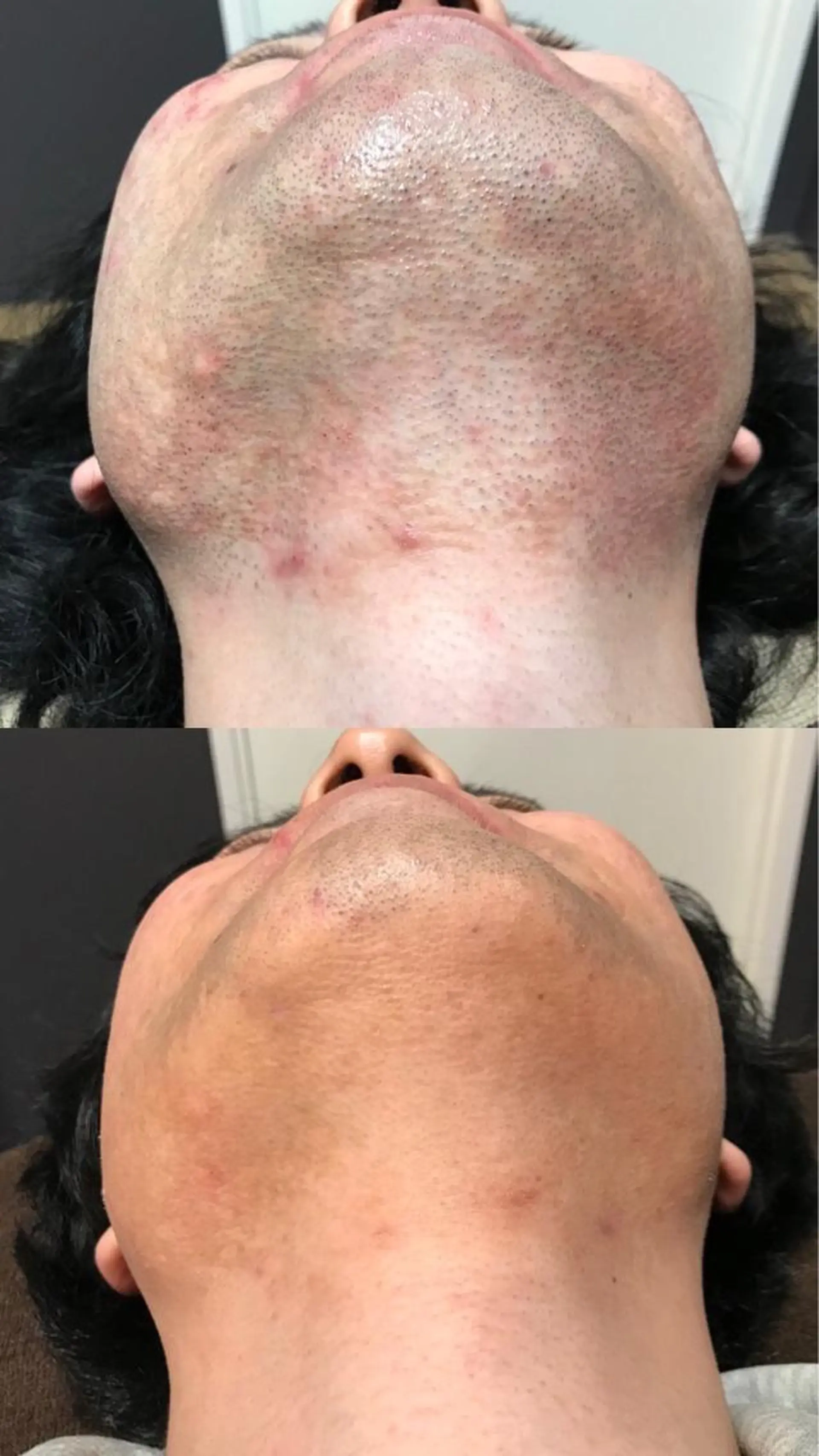 Lilyboo 星のエステ・リラクイメージ