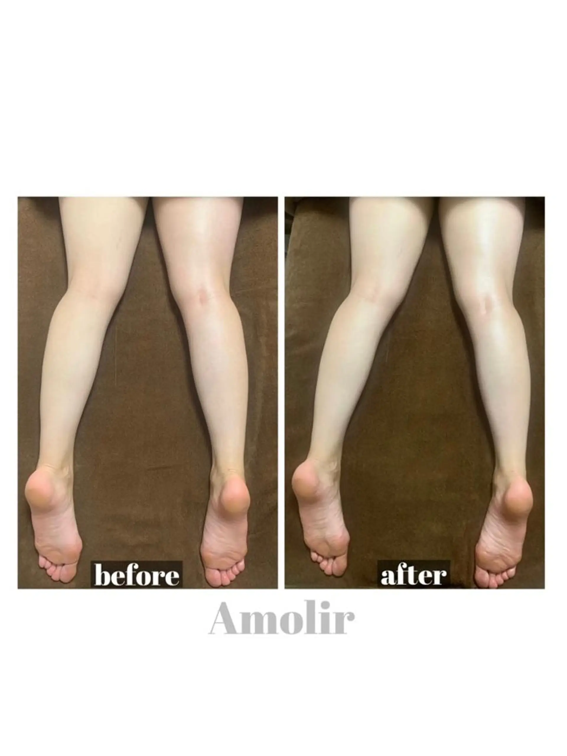 ボディメイクエステ Amolirのエステ・リラクイメージ