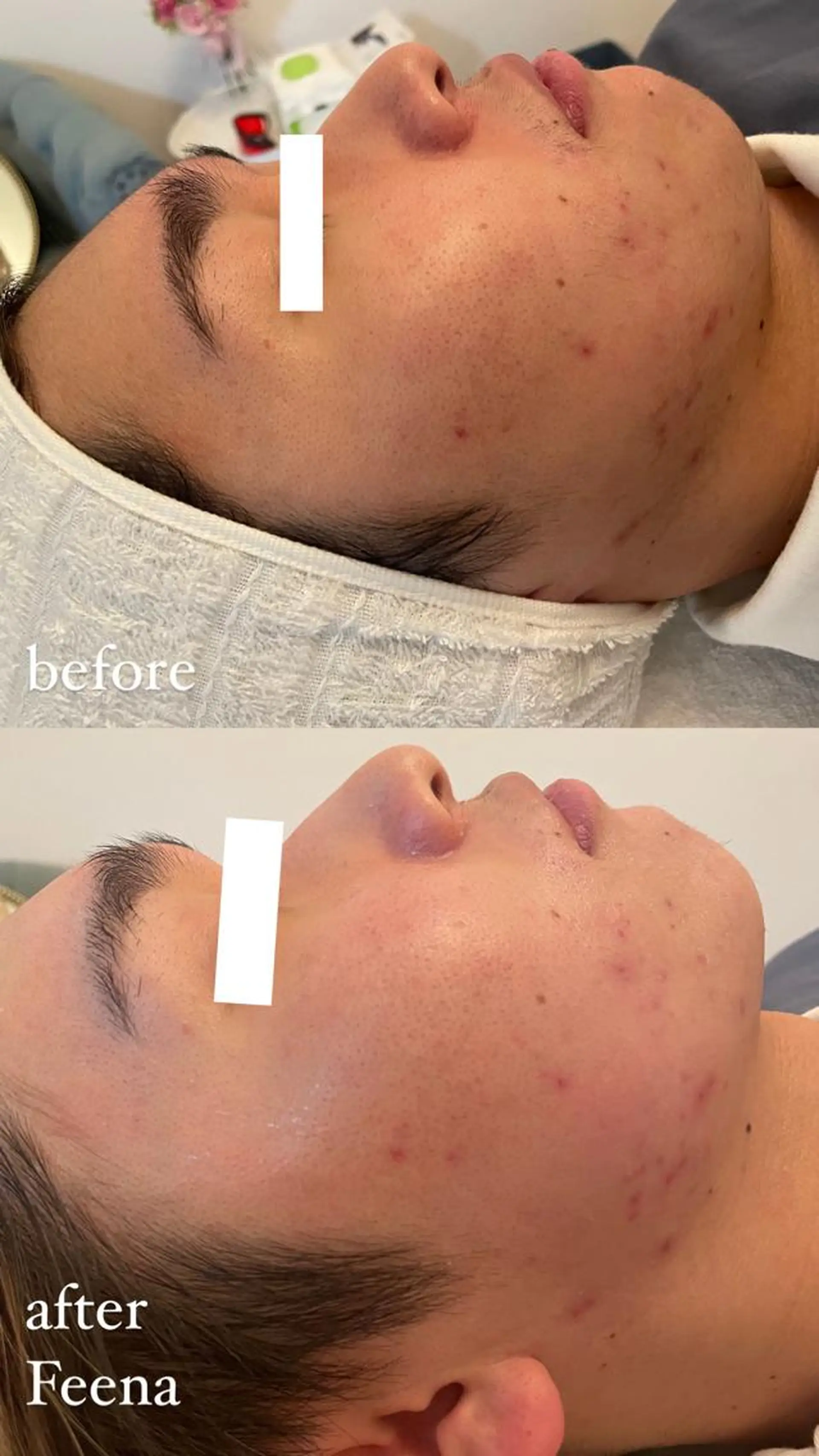 amu nail. RINAのネイルデザイン