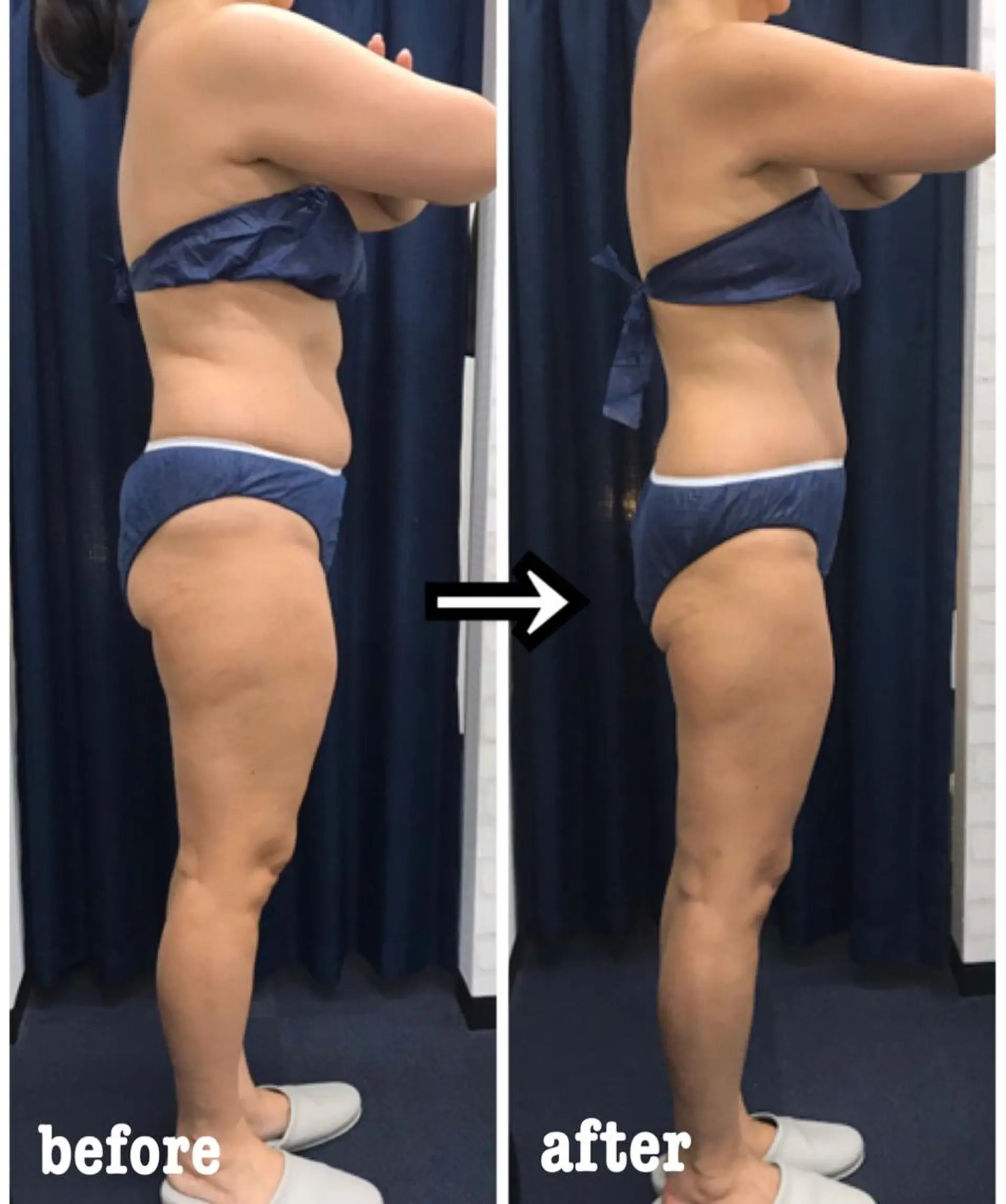 エステ リラク アイトータル ビューティーのエステ・リラクイメージ