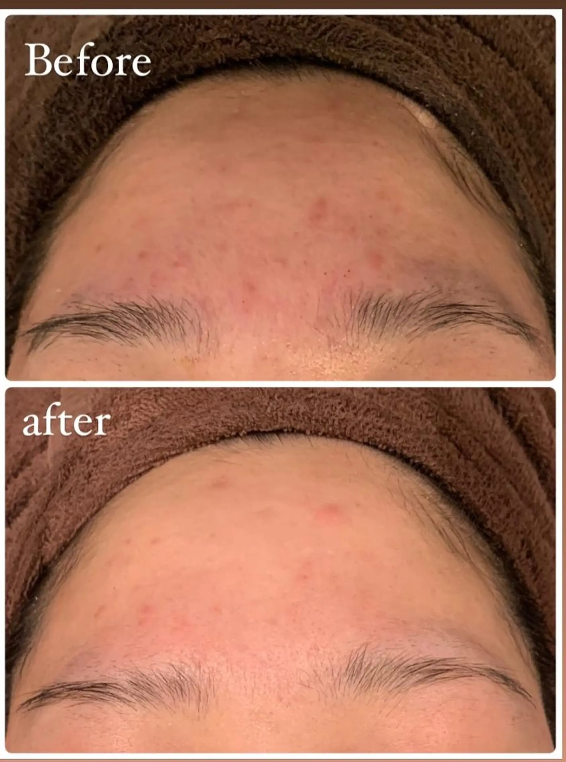 本気の肌質改善スキン デトックス🌿のエステ・リラクイメージ