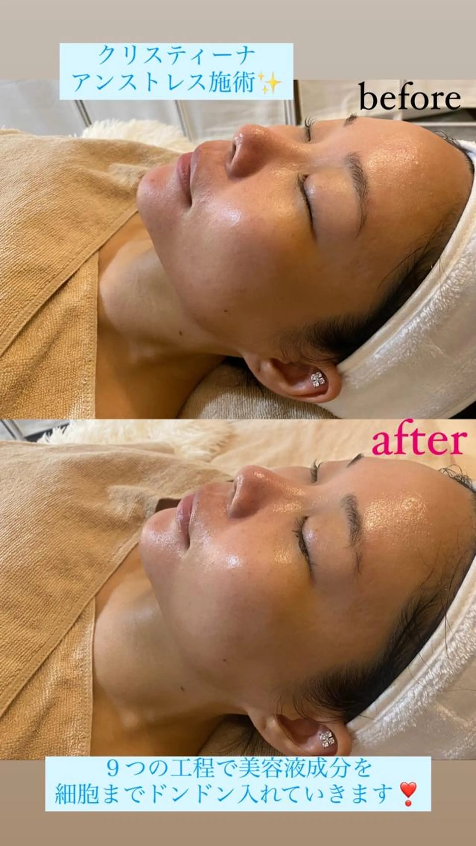 エステ Salon de Lino 御器所のエステ・リラクイメージ