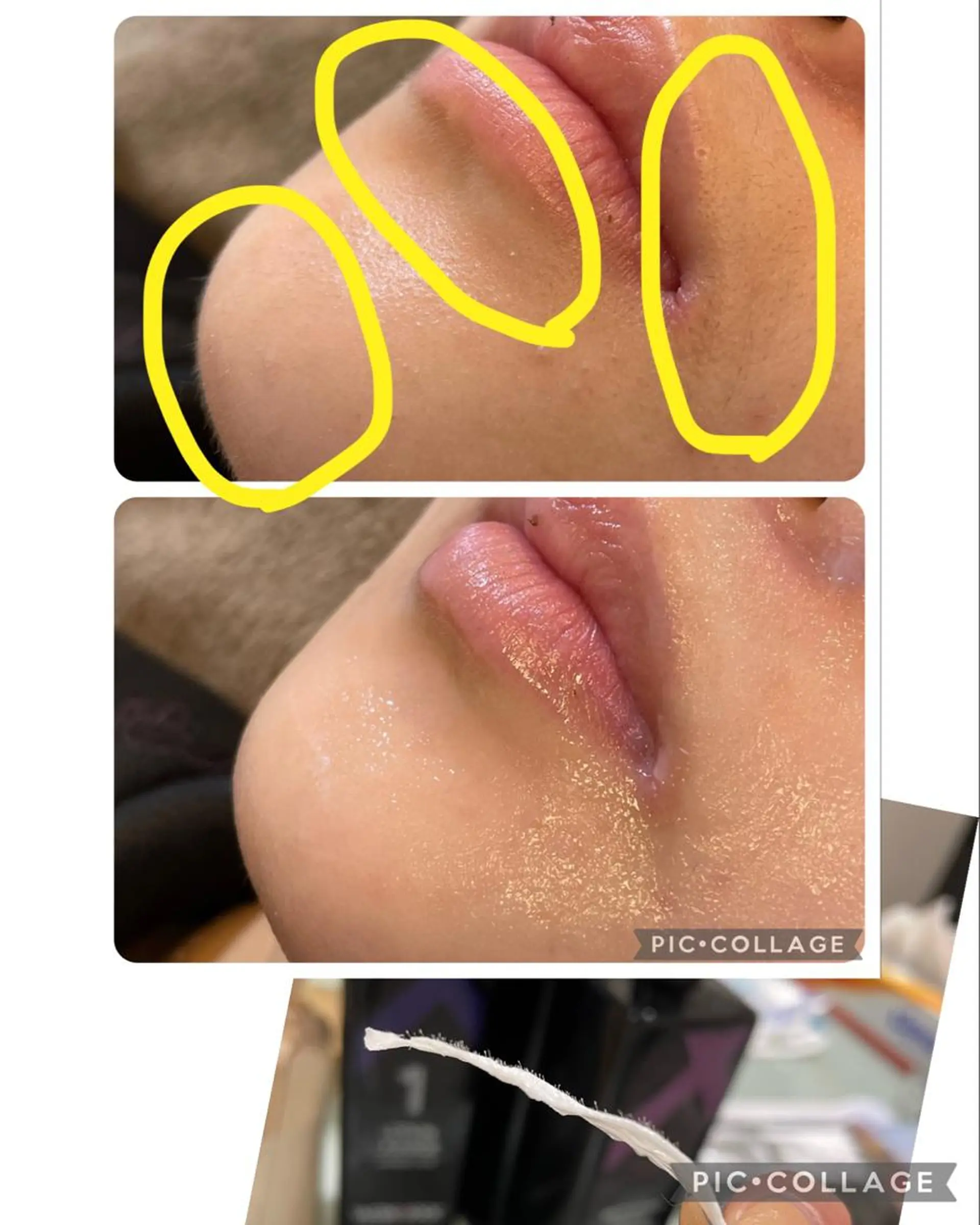 脱毛 R ...Rの眉毛・アイブロウイメージ