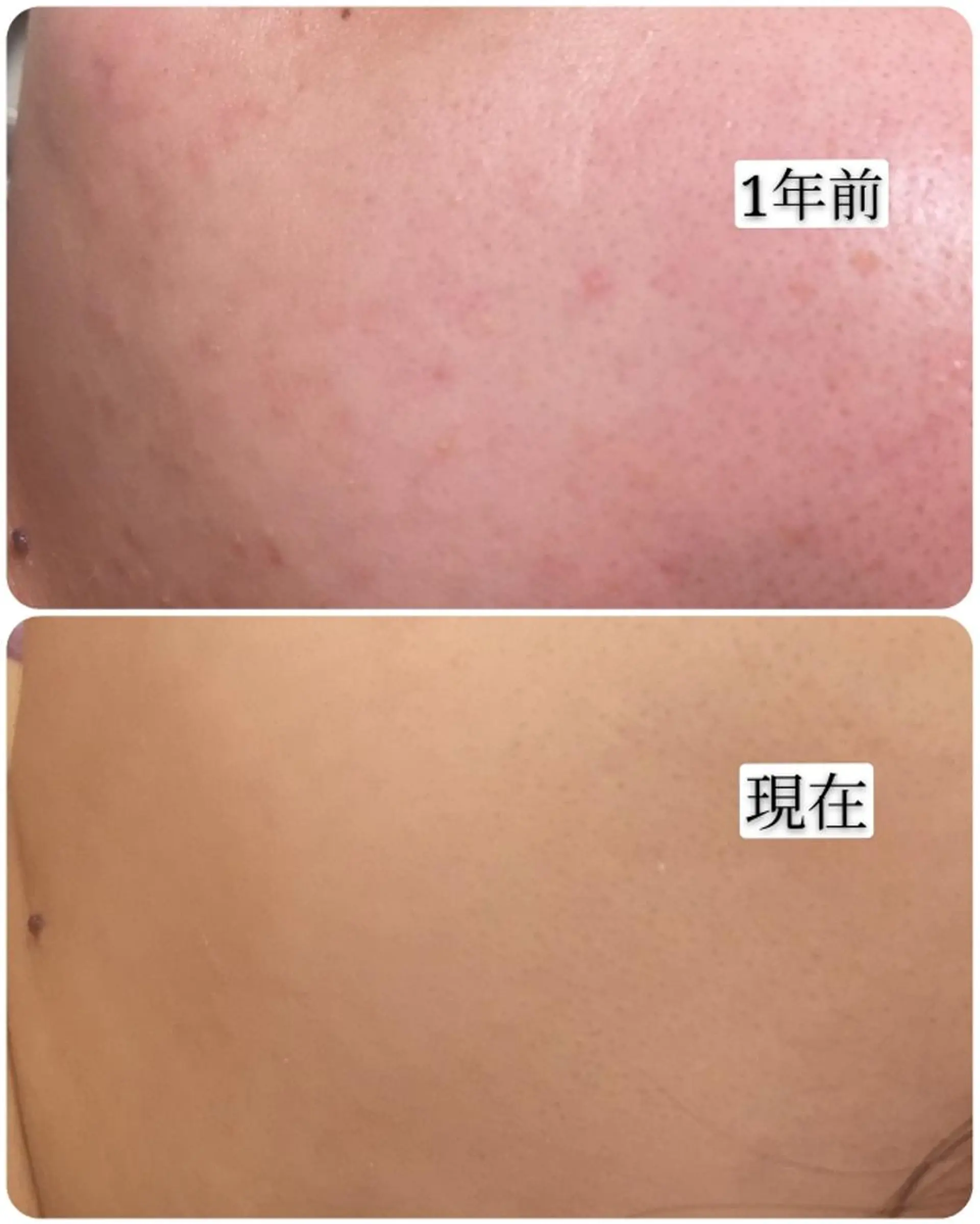 エステ 🅖🅤🅩🅔🅛 salonのエステ・リラクイメージ