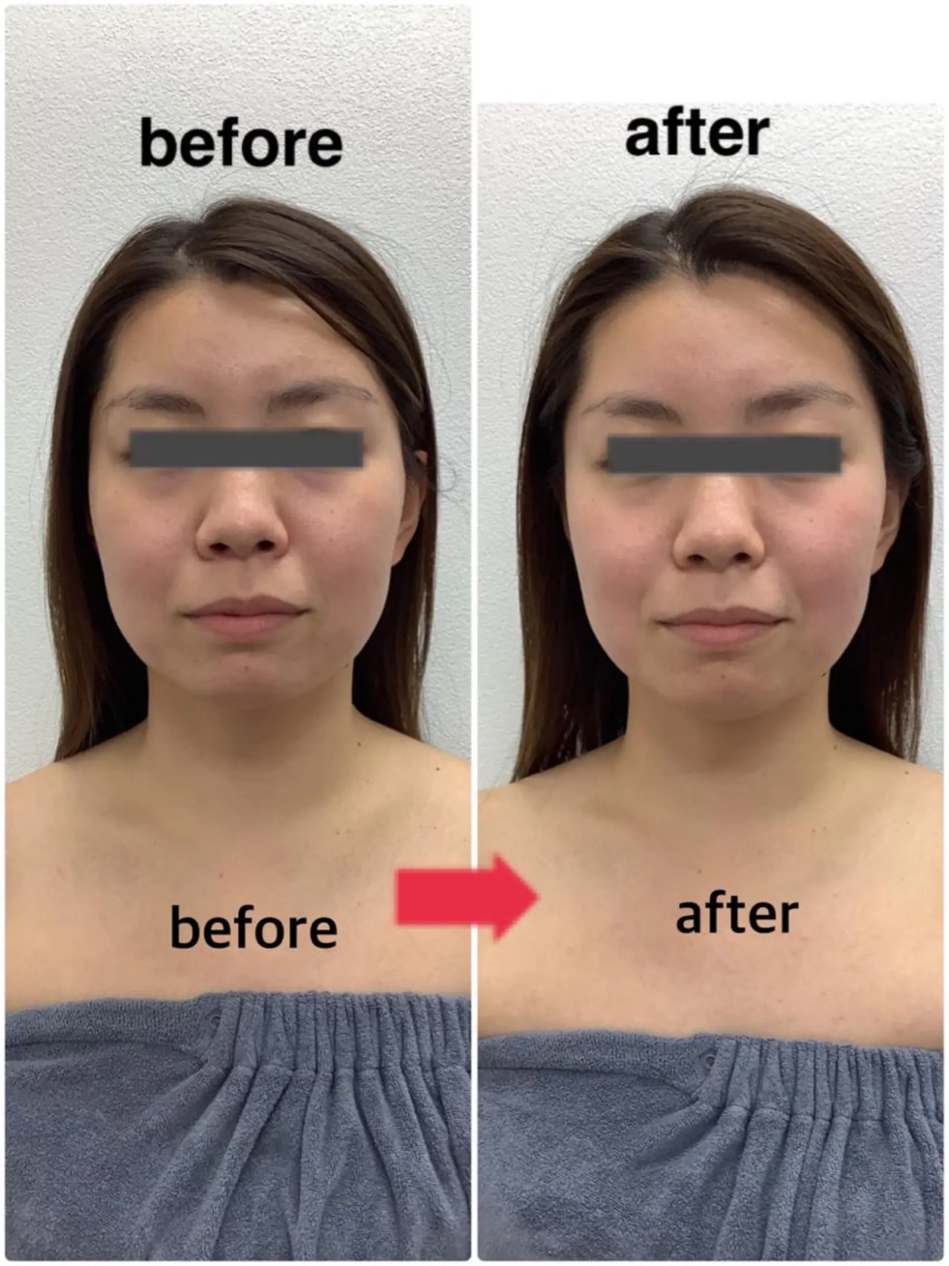 エステ リラク メディカルサロンドオフ所属・ハリサロンドオフ 美容鍼灸×小顔整体のエステ・リラクイメージ